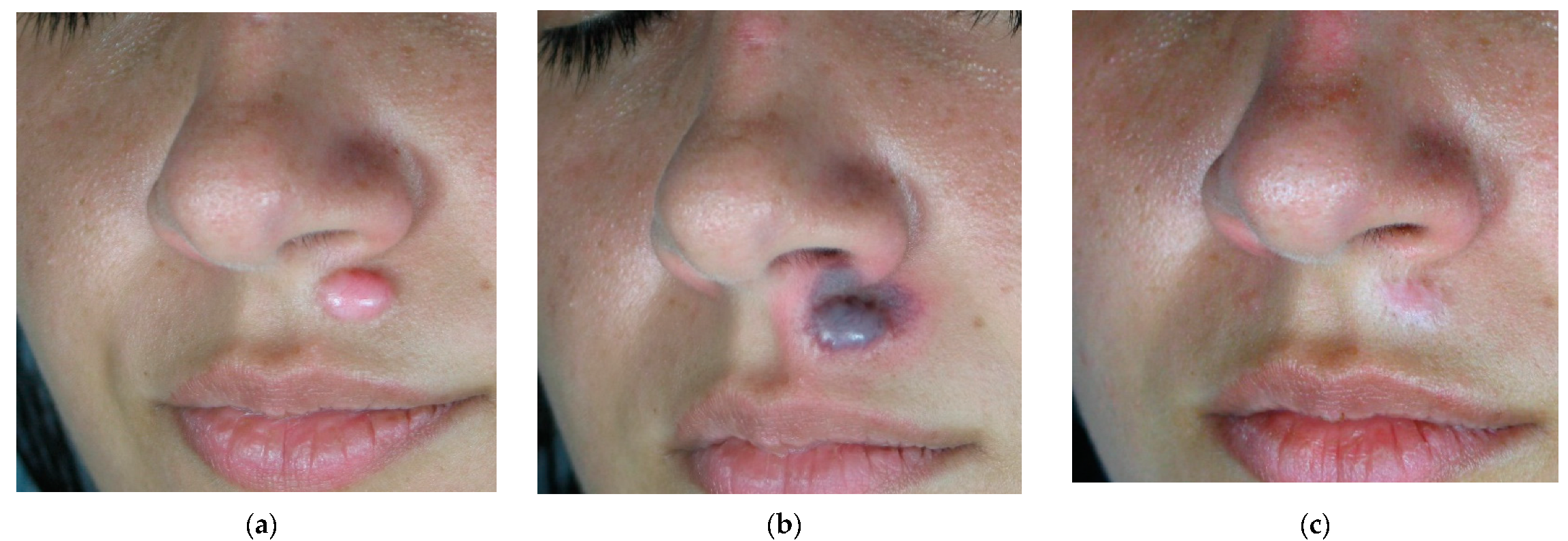 Cosmetics 11 00227 g002