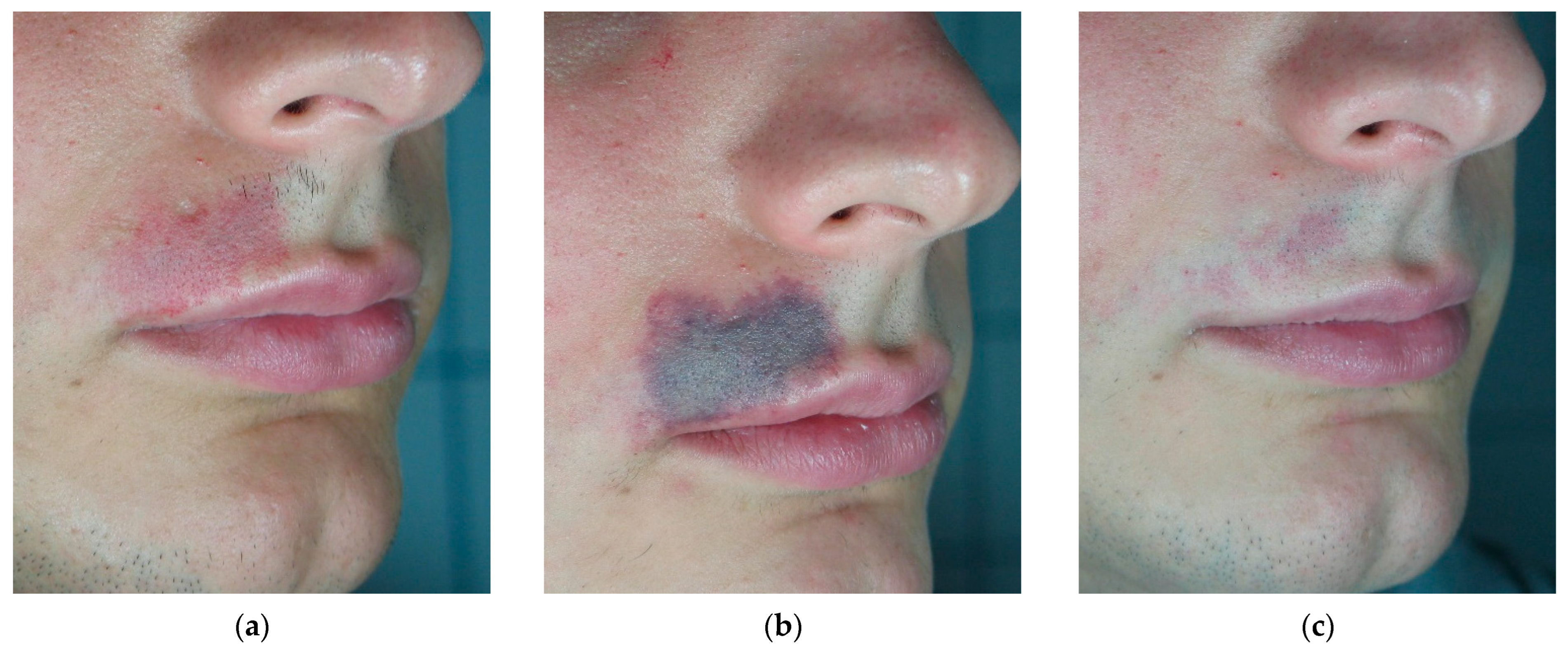 Cosmetics 11 00227 g004