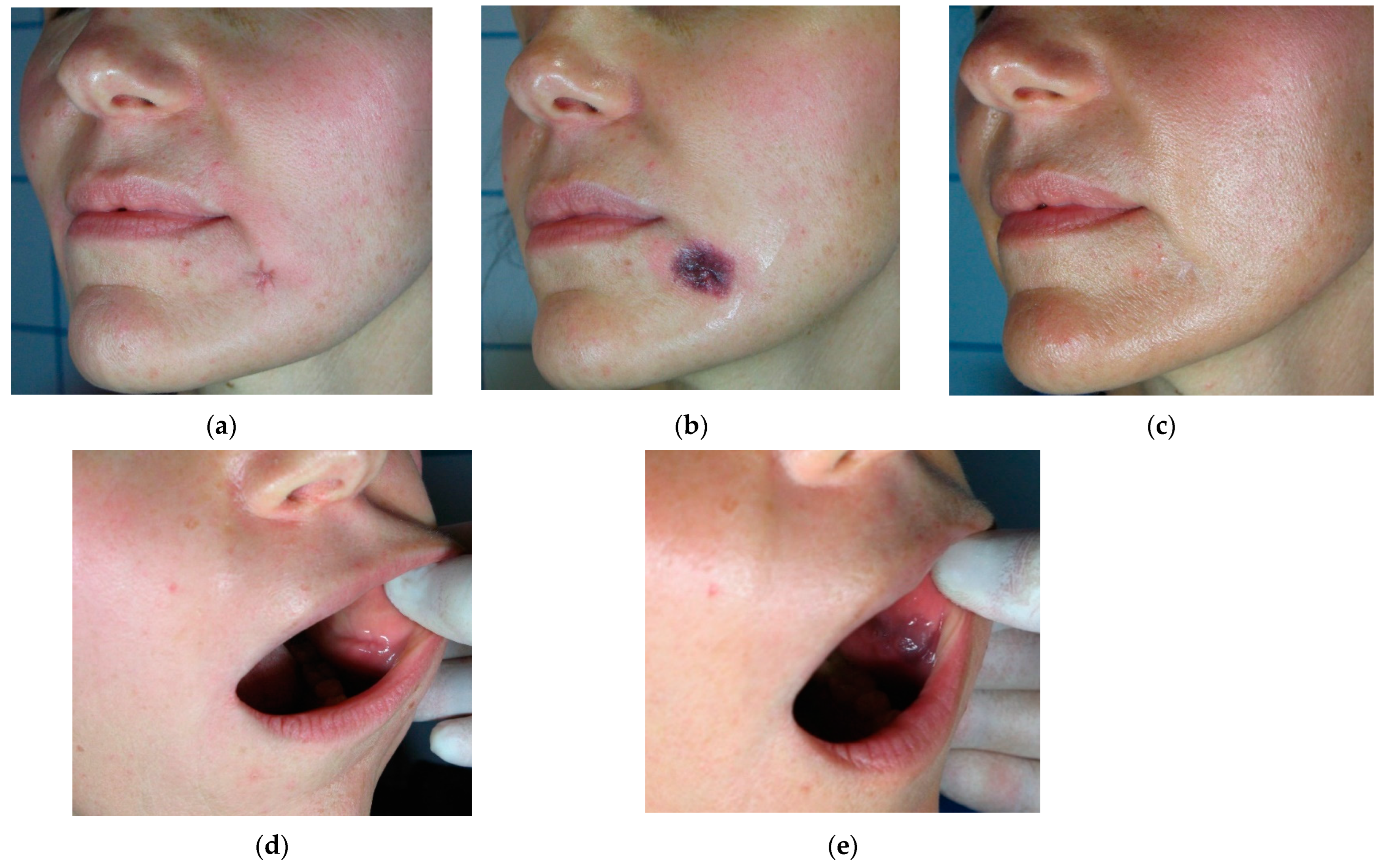 Cosmetics 11 00227 g005