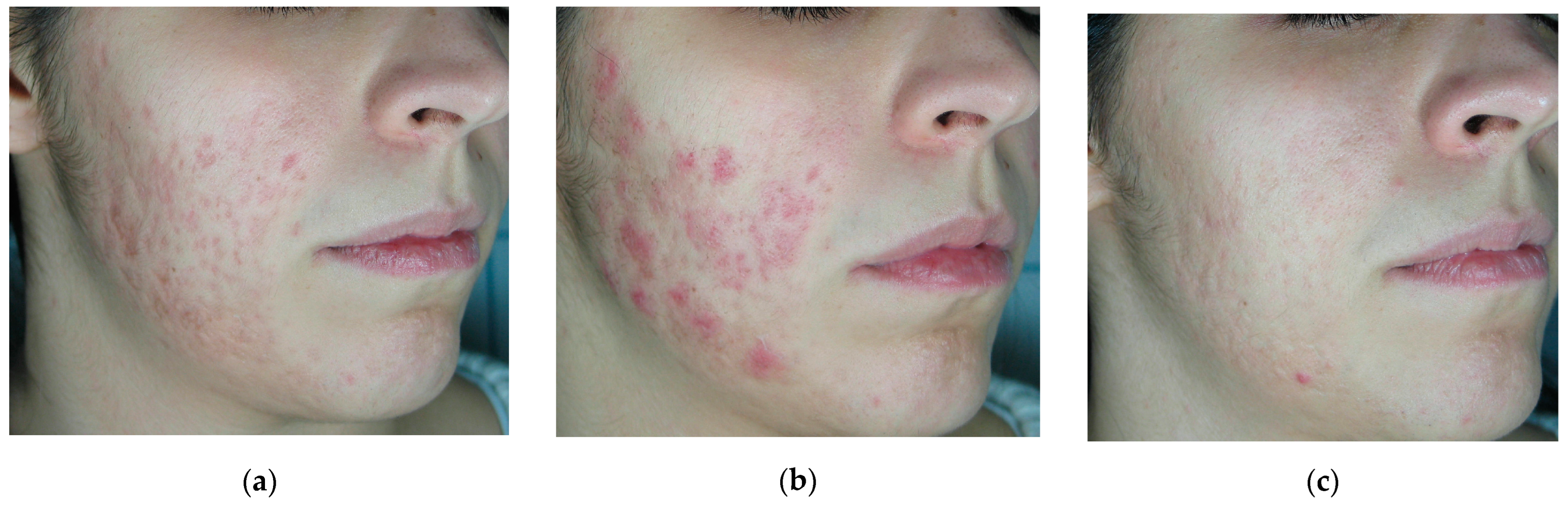 Cosmetics 11 00227 g006