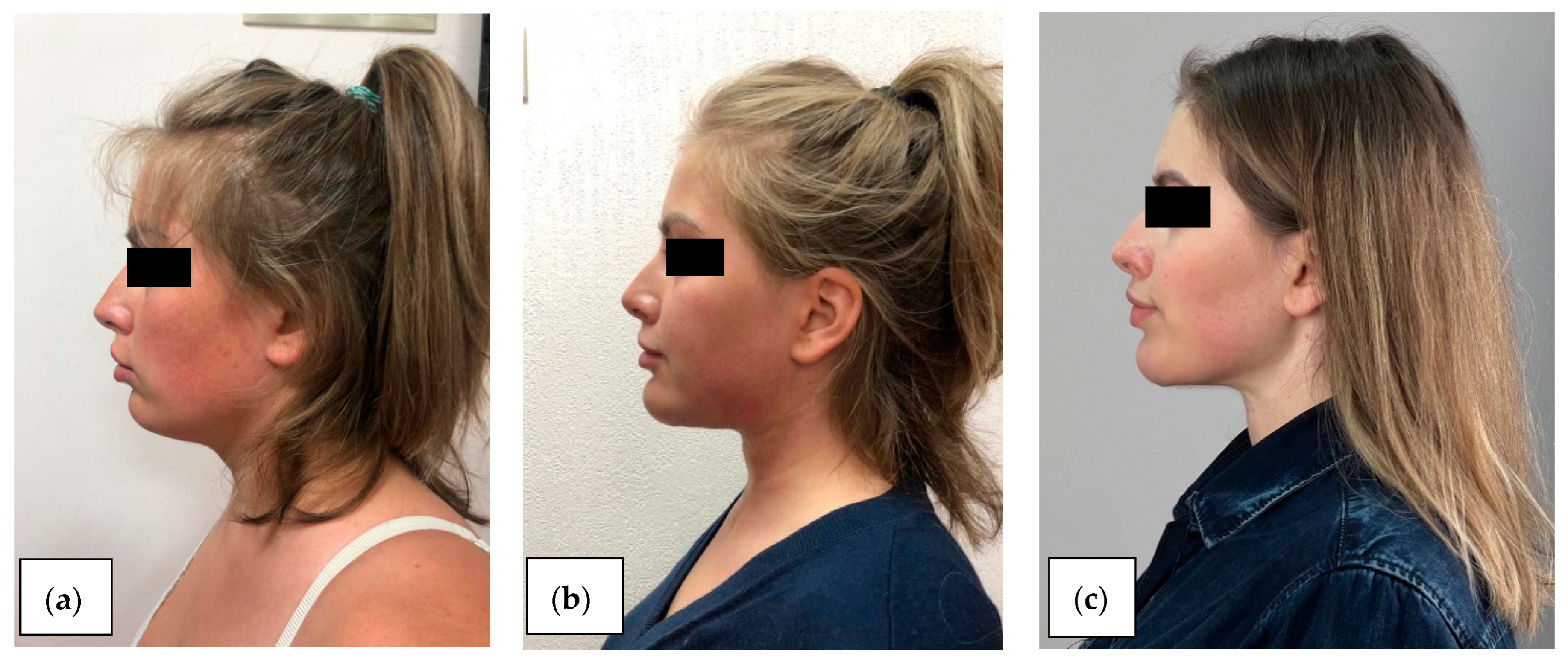 Cosmetics 12 00025 g004