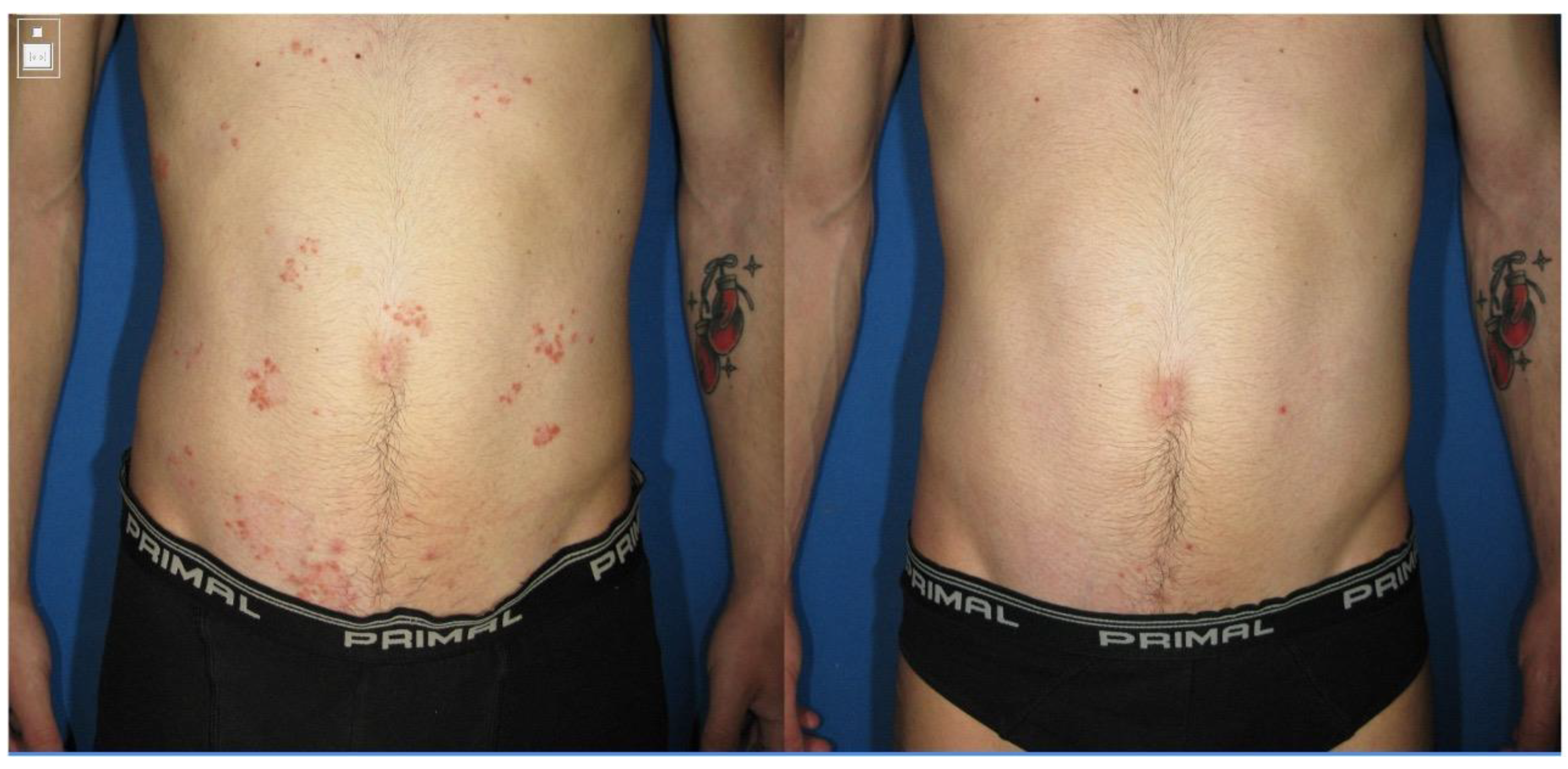 Cosmetics 12 00030 g001 Cosmetics 12 00030 g001