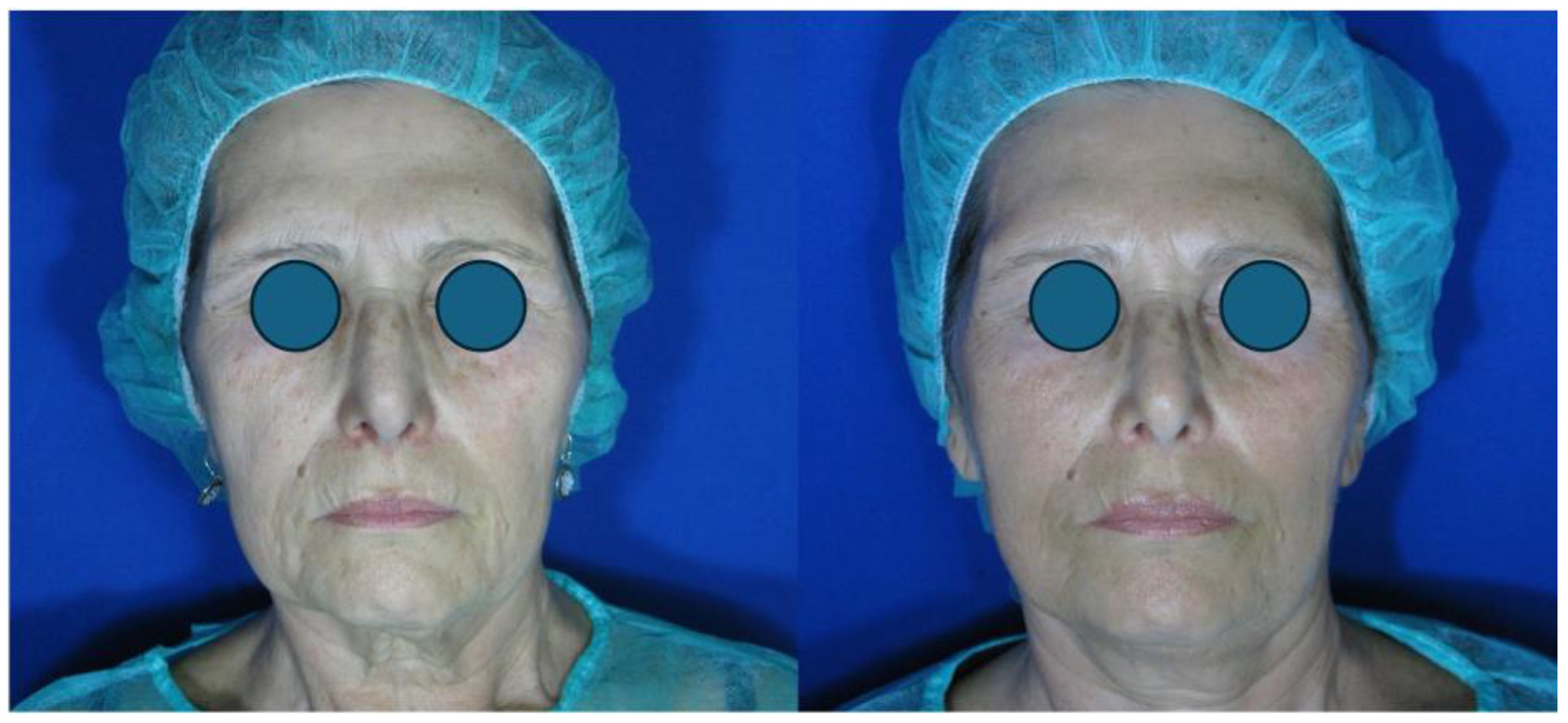 Cosmetics 12 00030 g003 Cosmetics 12 00030 g003