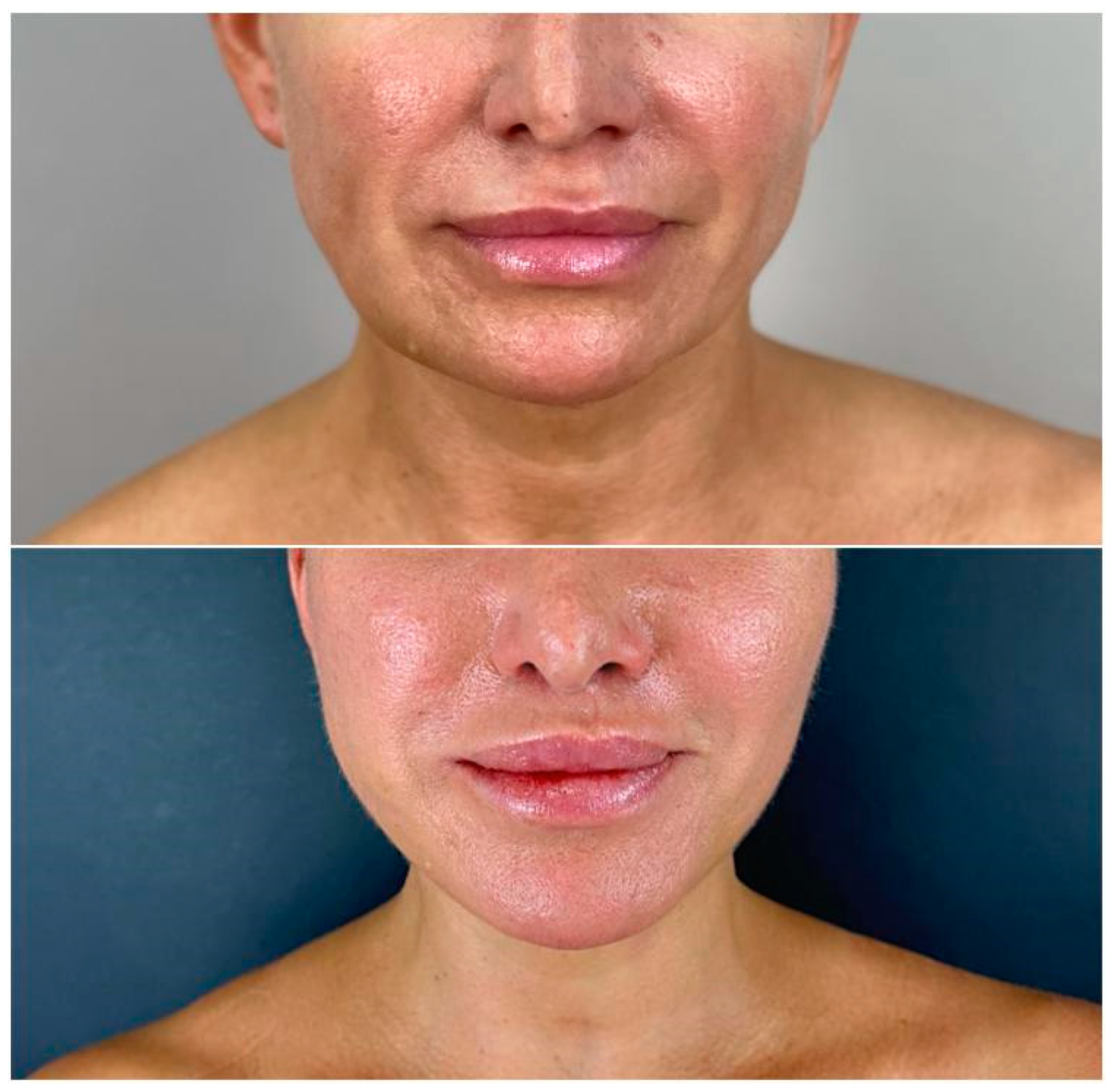 Cosmetics 12 00039 g015