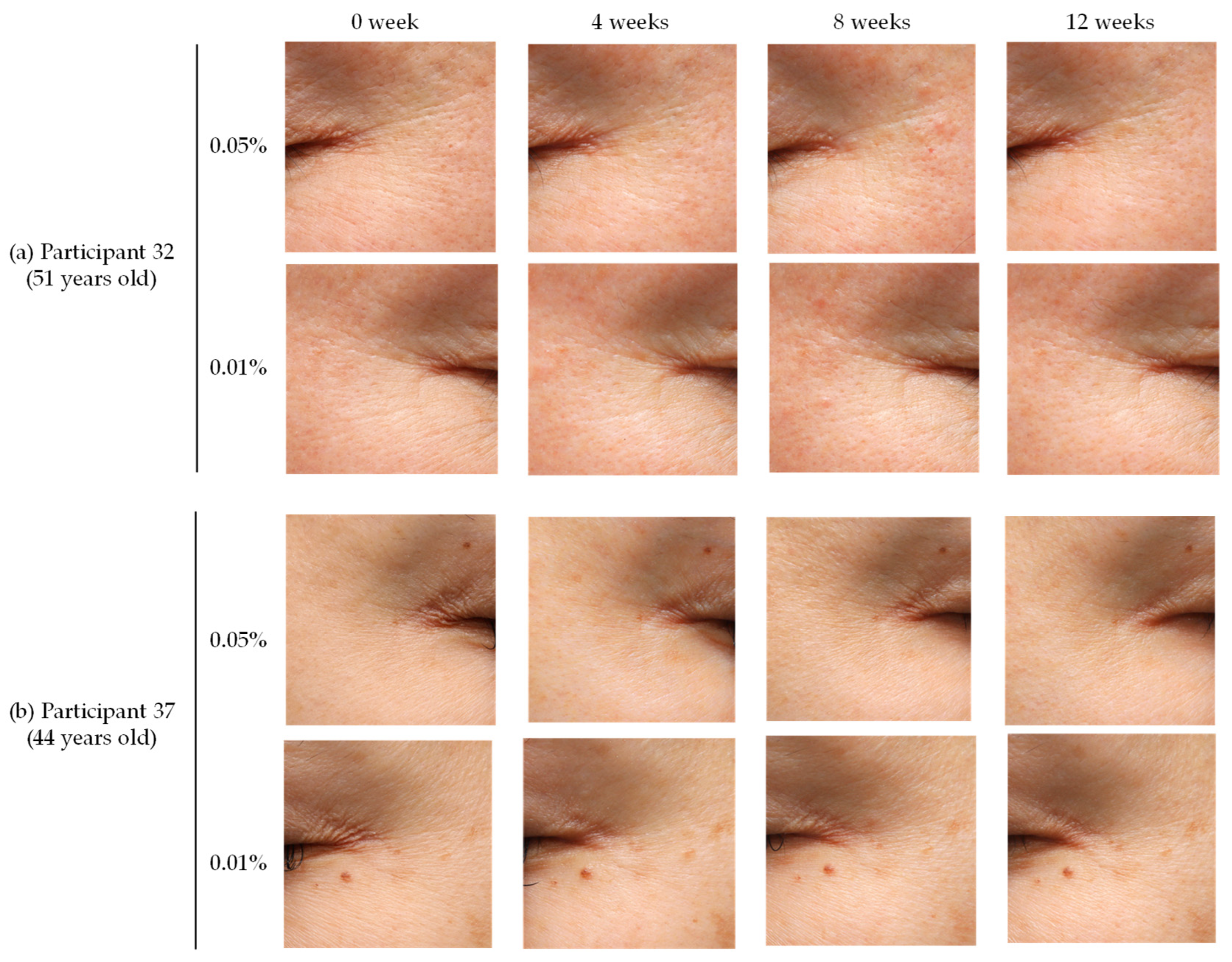 Improvement in Wrinkles by a Fairy Chemical, 2-Aza-8