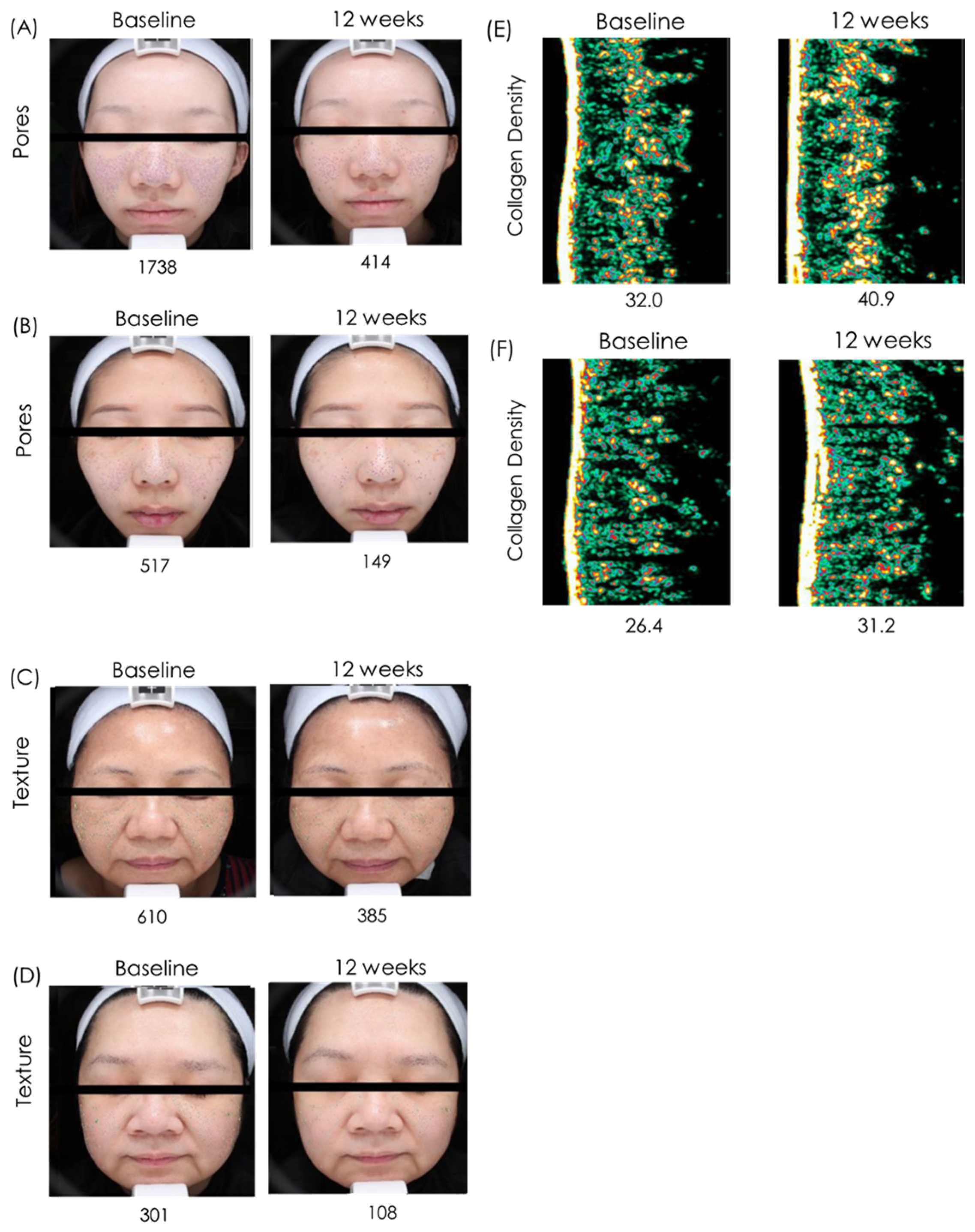 Cosmetics 12 00131 g003