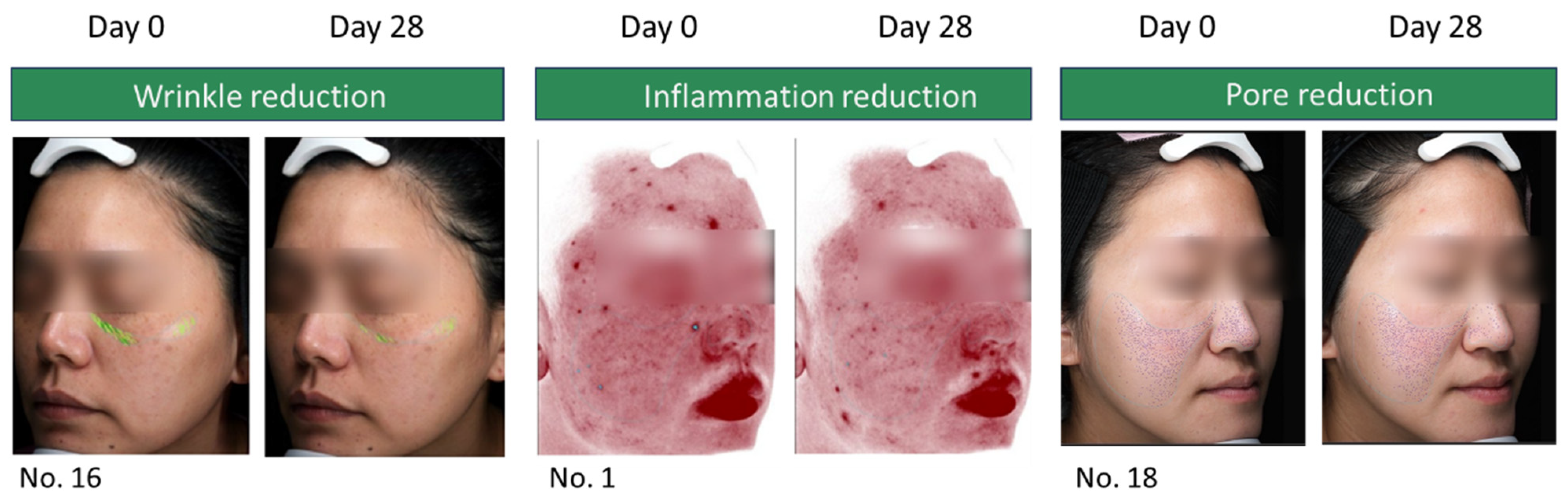 Cosmetics 12 00186 g004