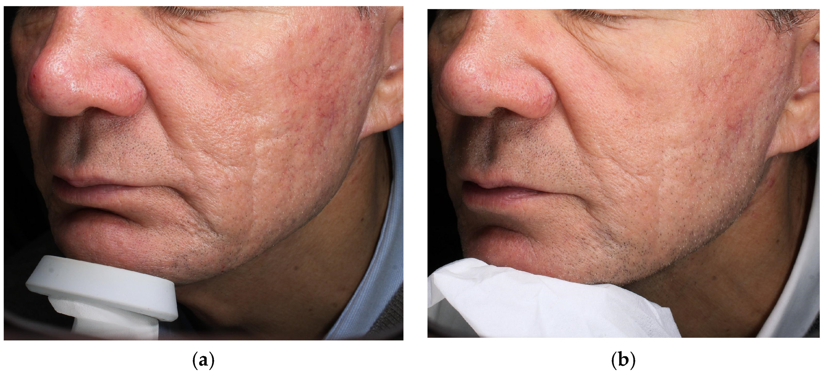 Cosmetics 12 00199 g002