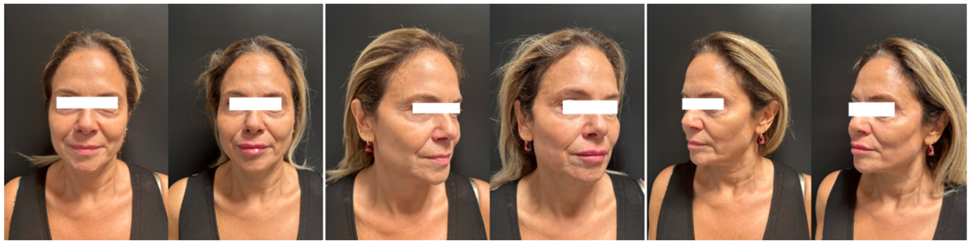 Cosmetics 12 00212 g002