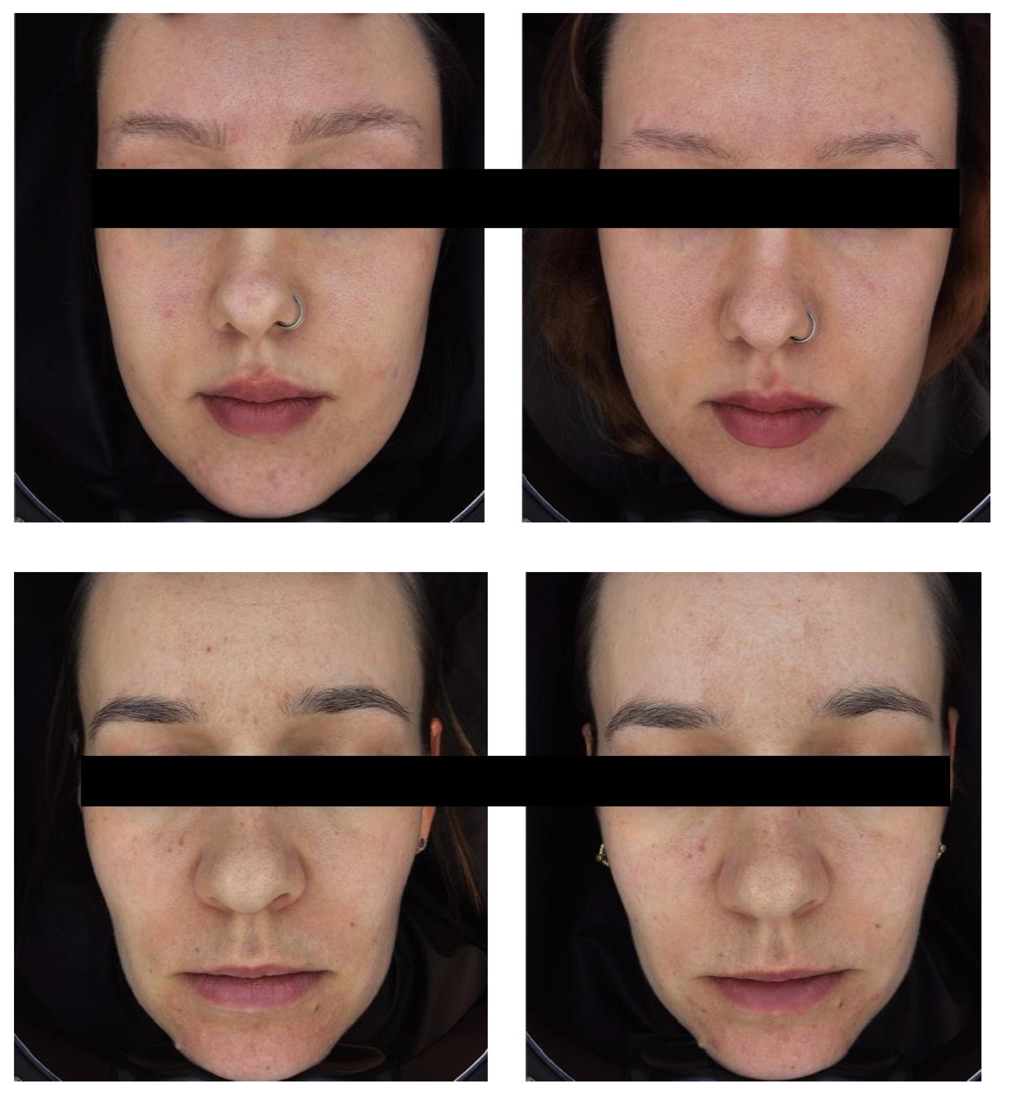 Cosmetics 12 00220 g001b