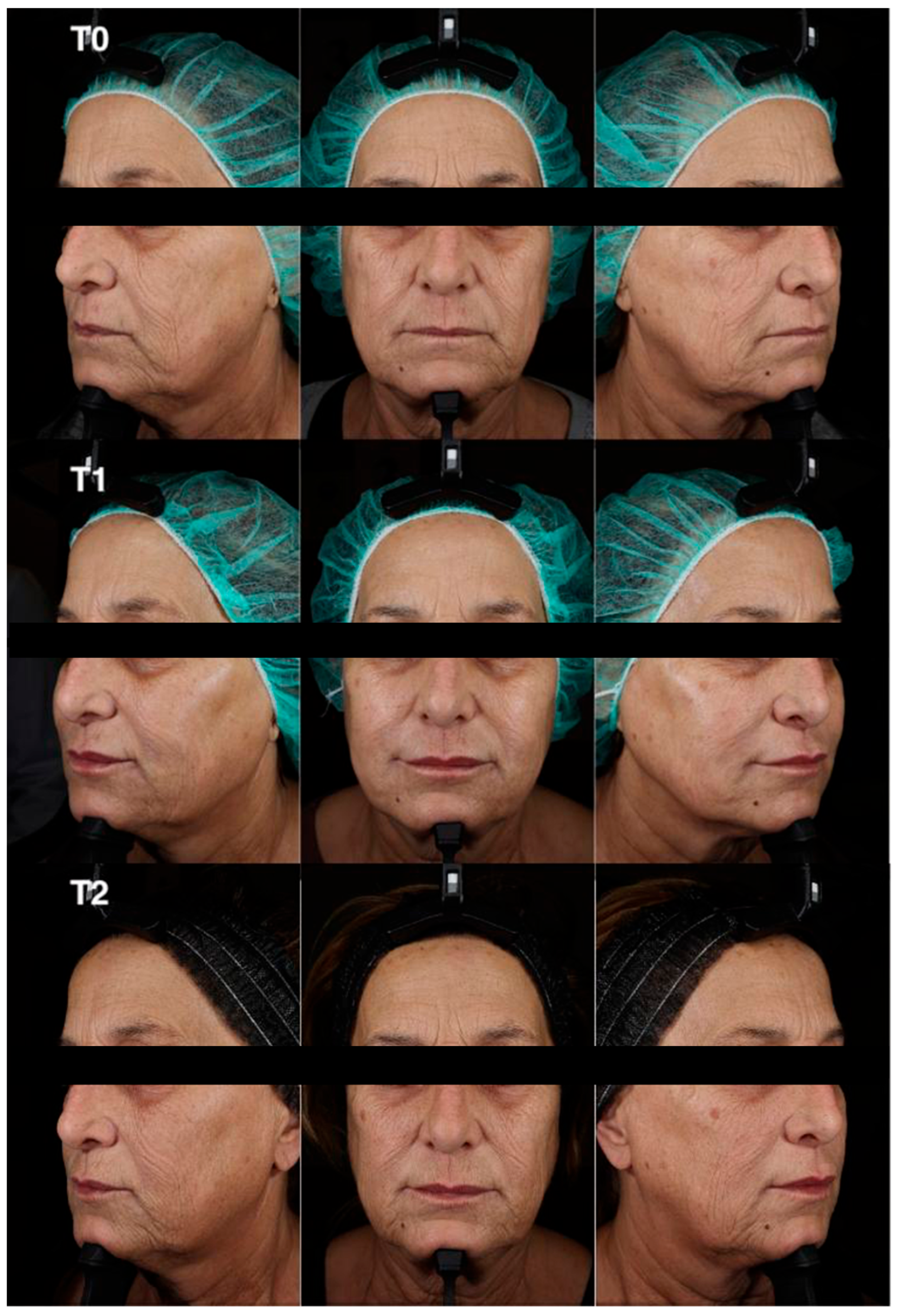 Cosmetics 12 00222 sch003