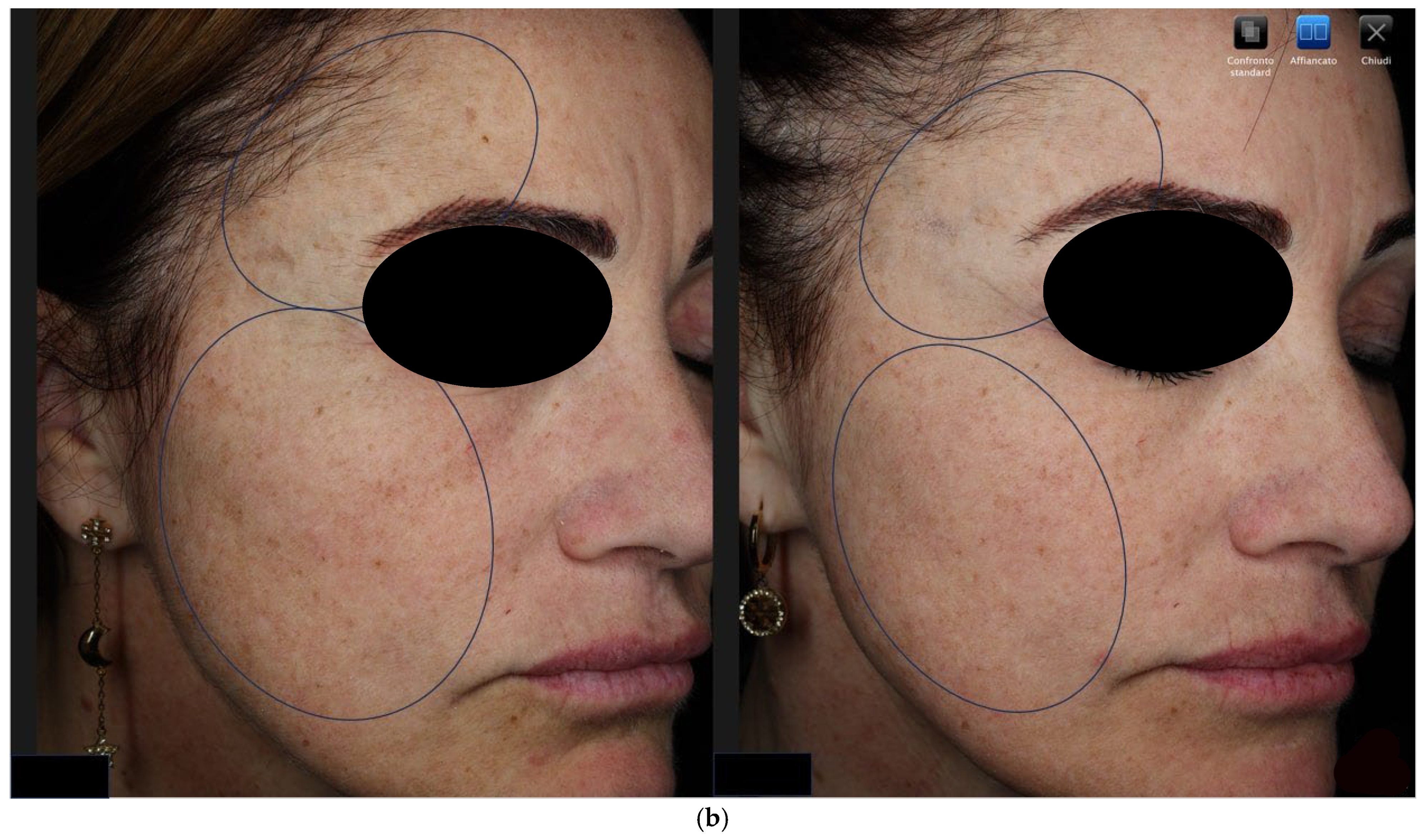 Cosmetics 12 00251 g001b