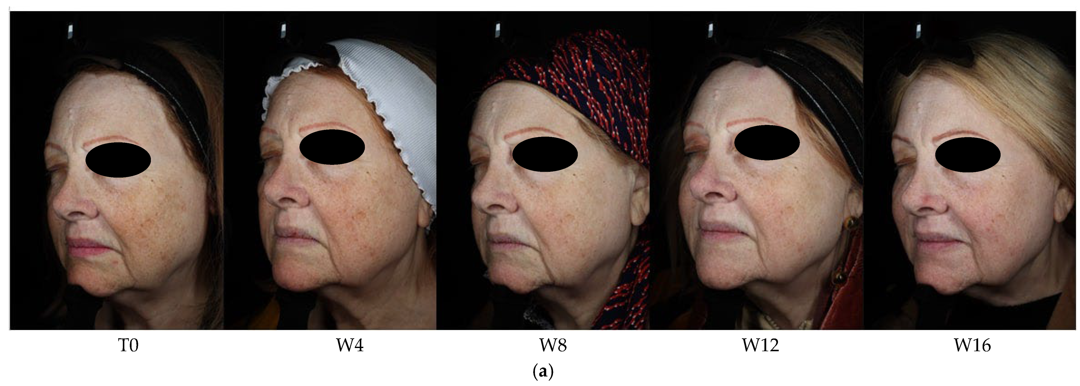 Cosmetics 12 00251 g002a