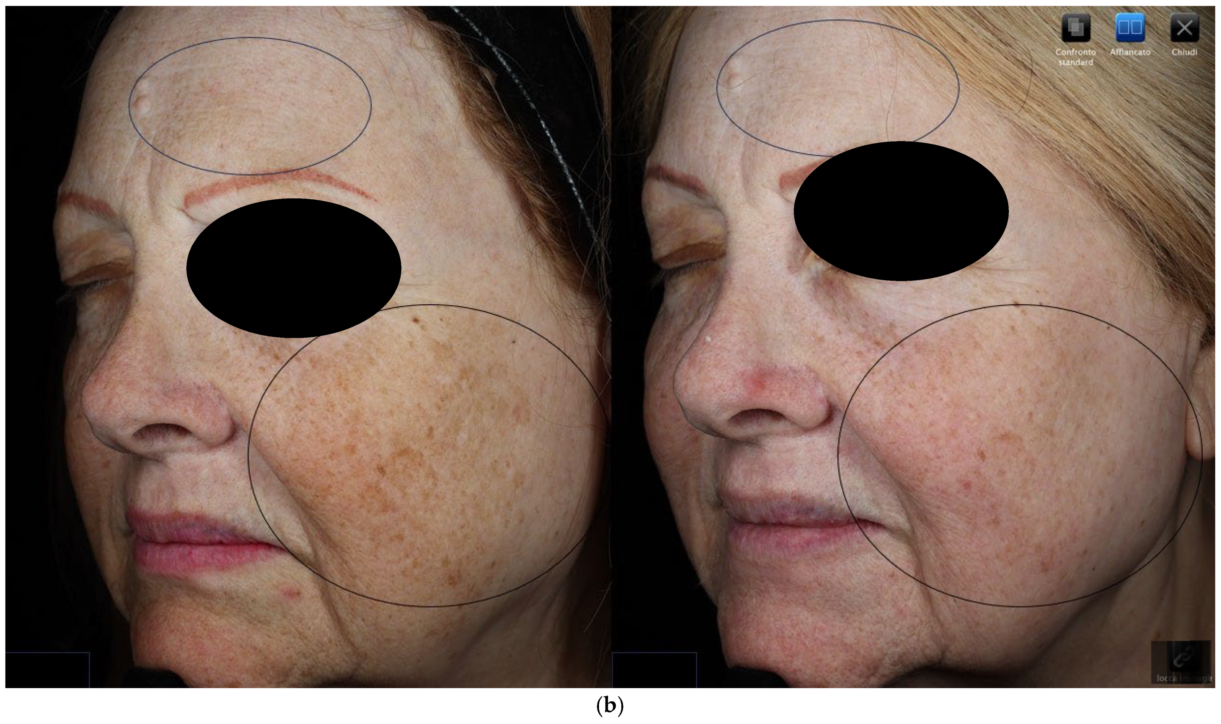 Cosmetics 12 00251 g002b