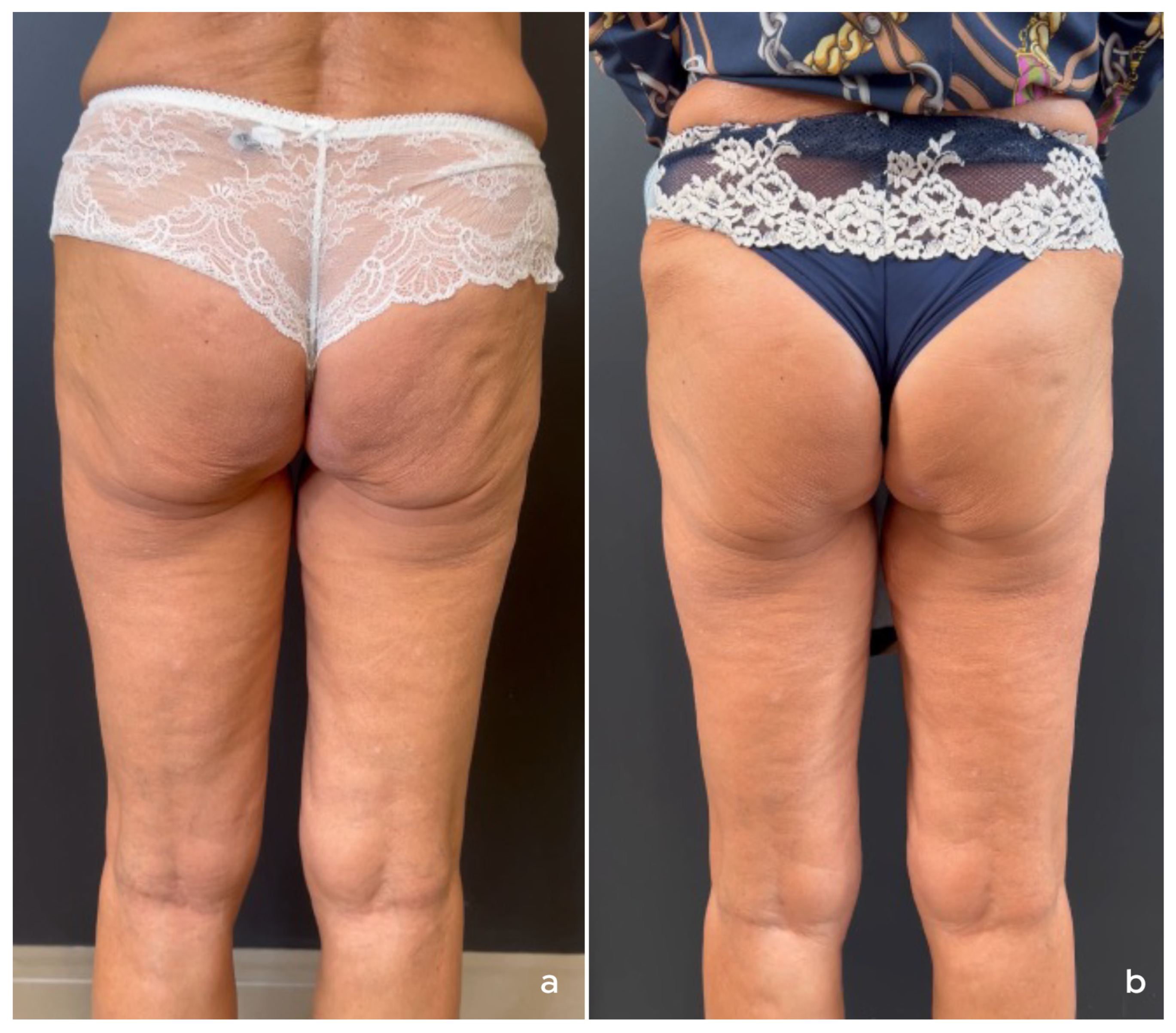 Cosmetics 12 00264 g003