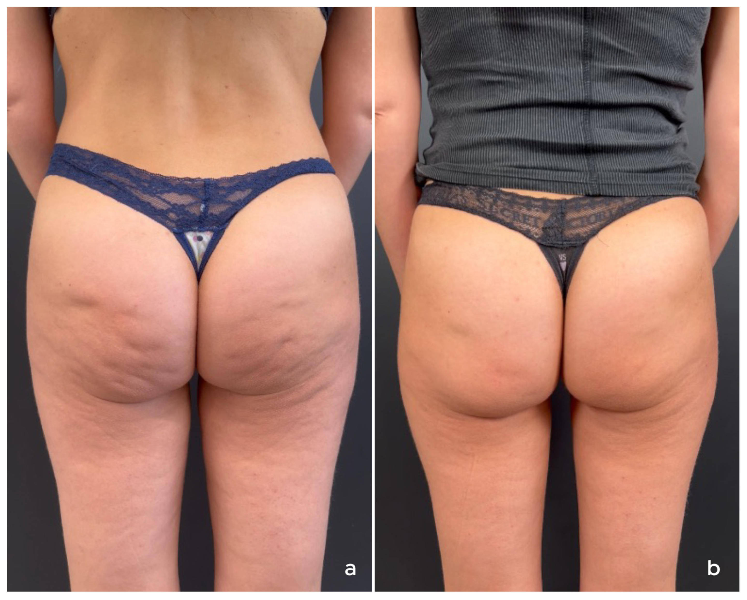 Cosmetics 12 00264 g004