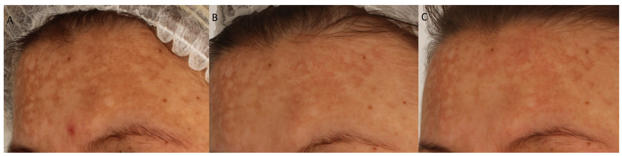 Cosmetics 12 00276 g002