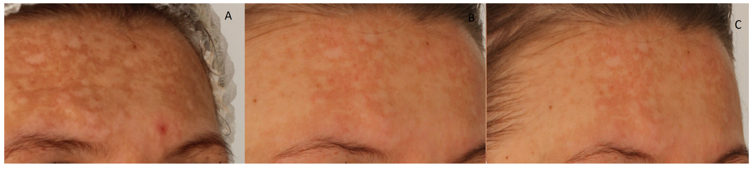 Cosmetics 12 00276 g003