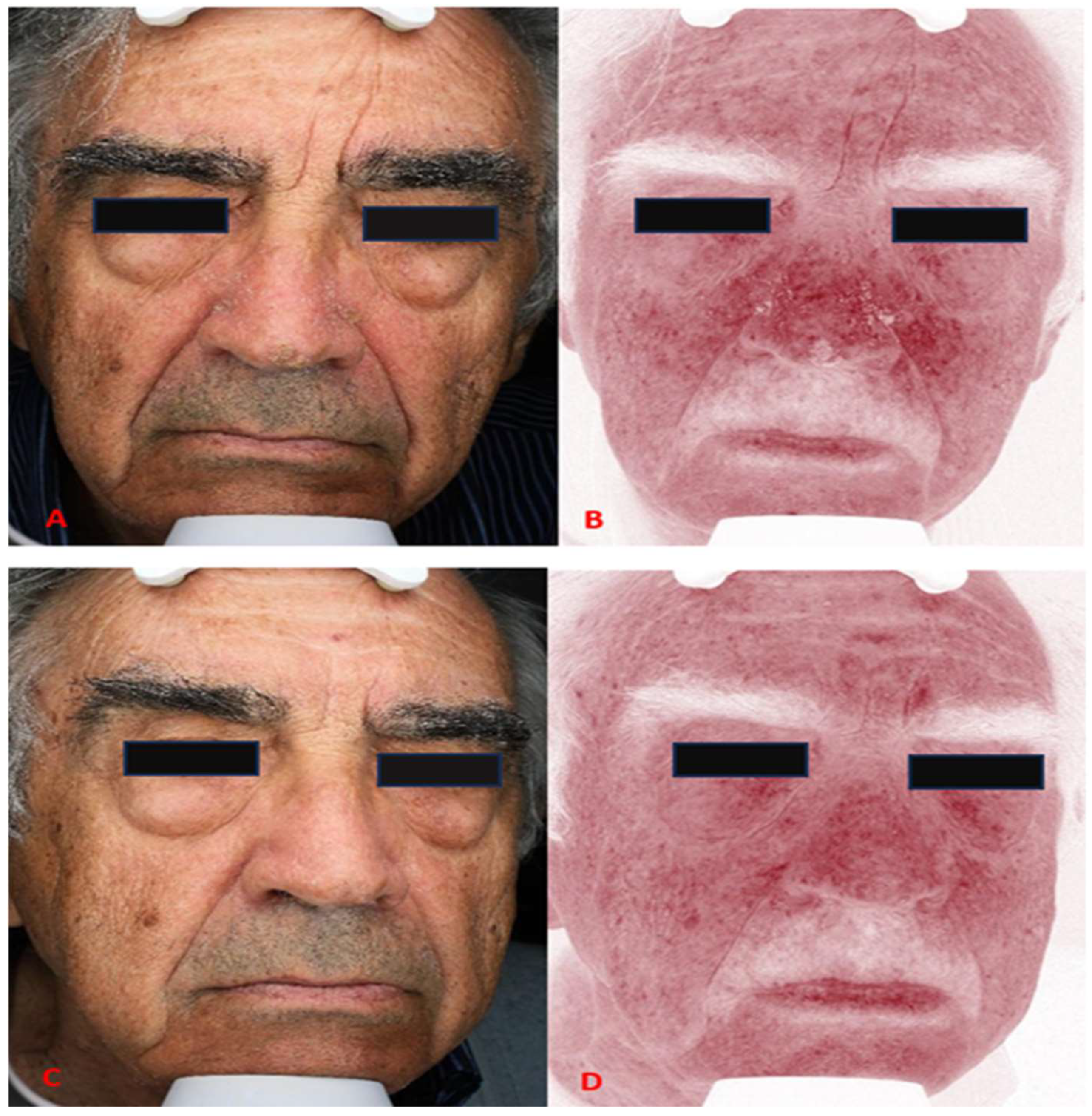 Cosmetics 12 00280 g001 Cosmetics 12 00280 g001