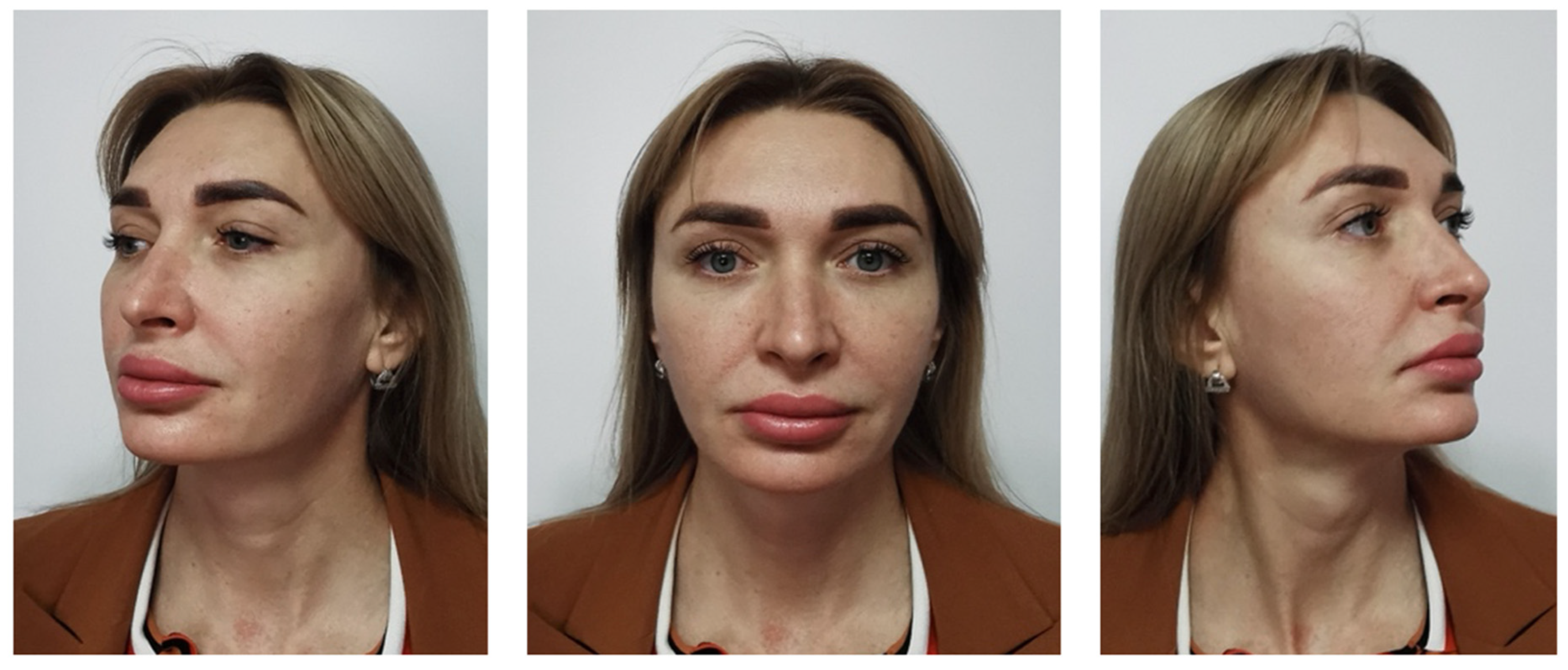 Cosmetics 13 00081 g010 Cosmetics 13 00081 g010