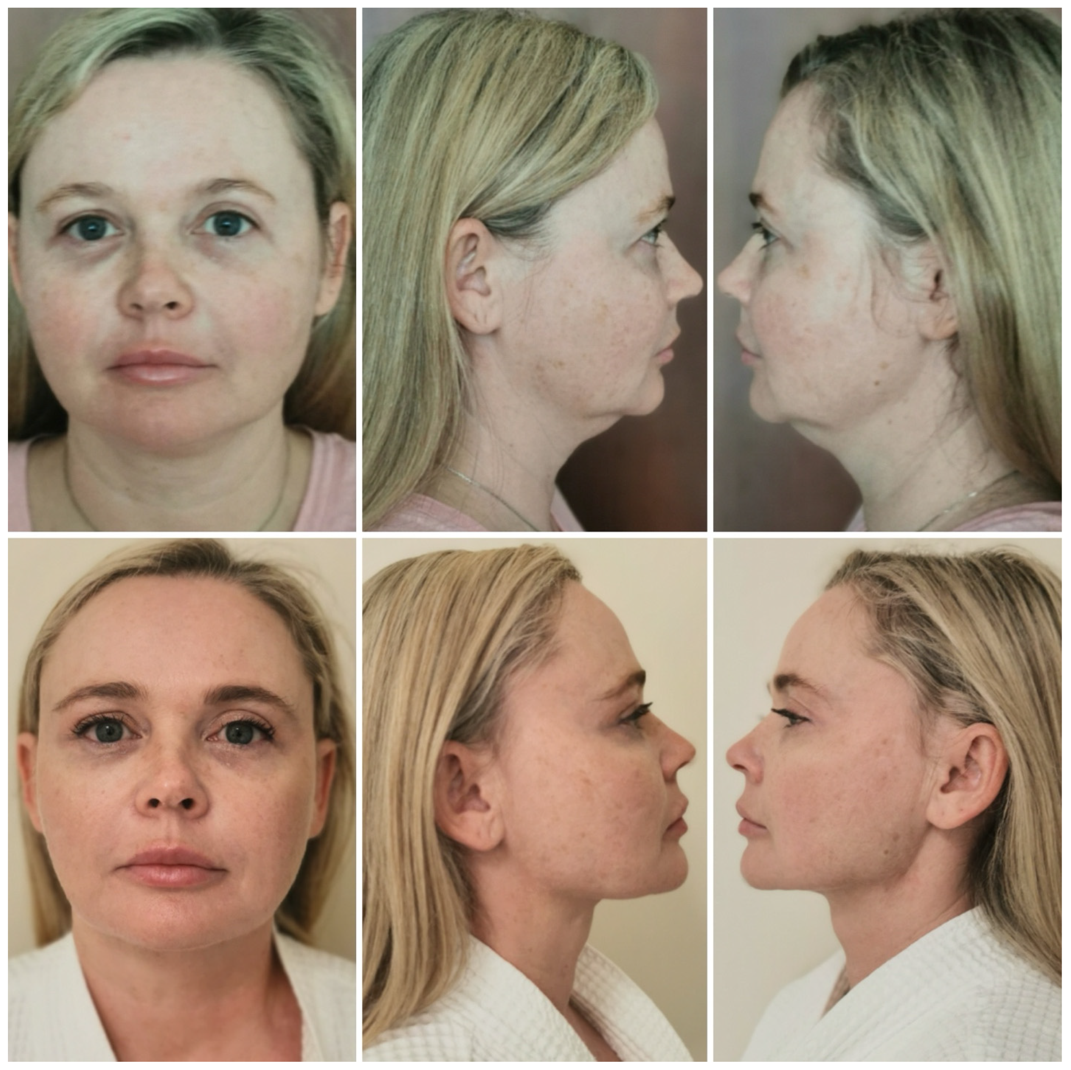 Cosmetics 13 00081 g011 Cosmetics 13 00081 g011