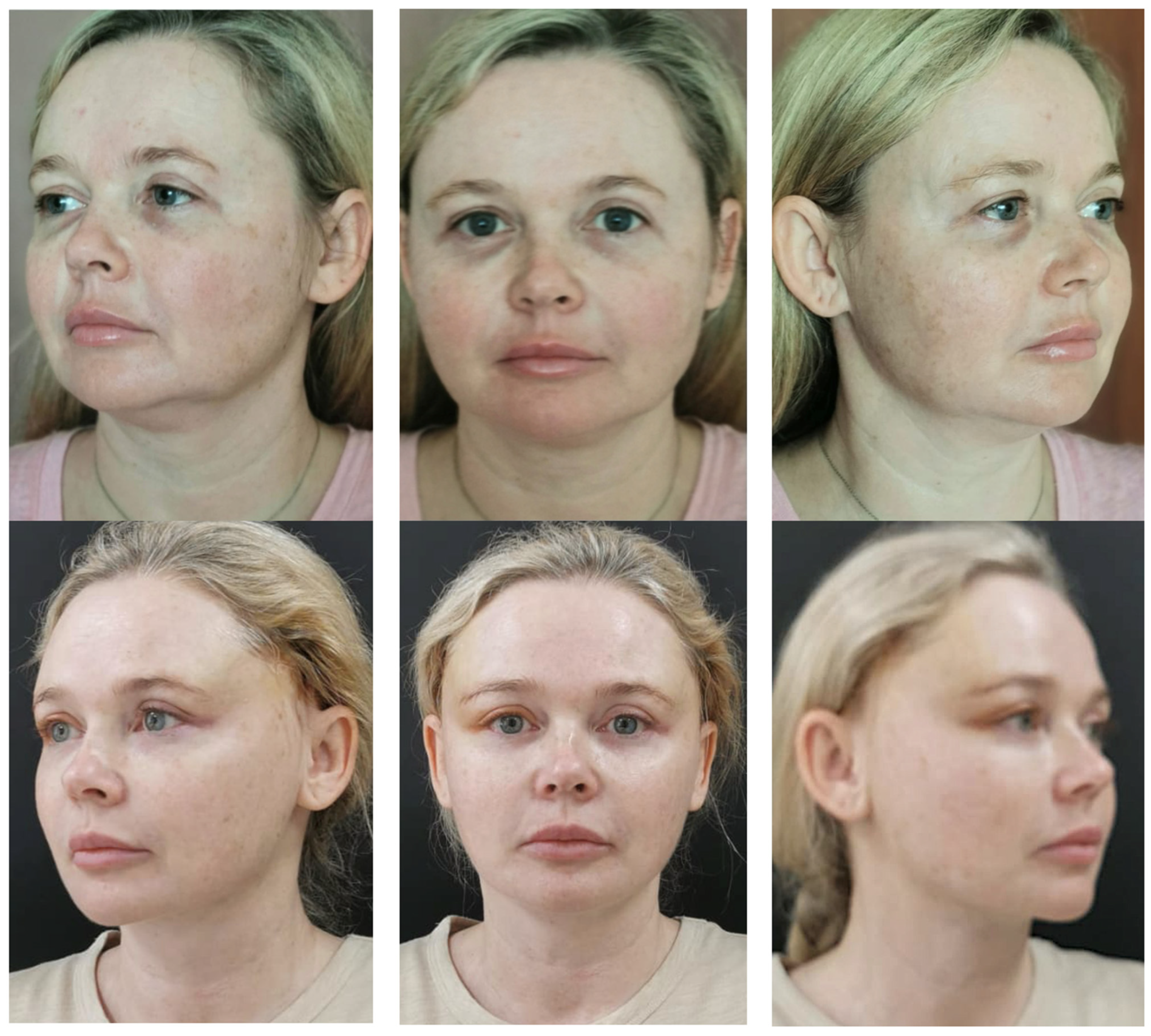 Cosmetics 13 00081 g012 Cosmetics 13 00081 g012