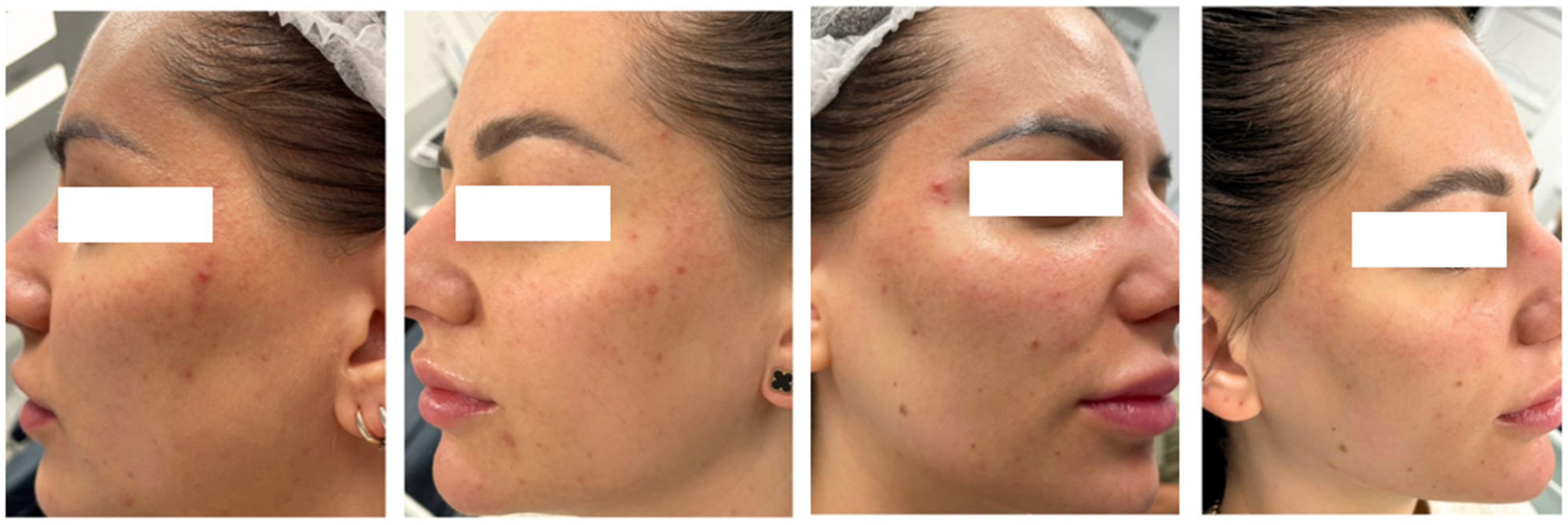 Cosmetics 13 00083 g008 Cosmetics 13 00083 g008