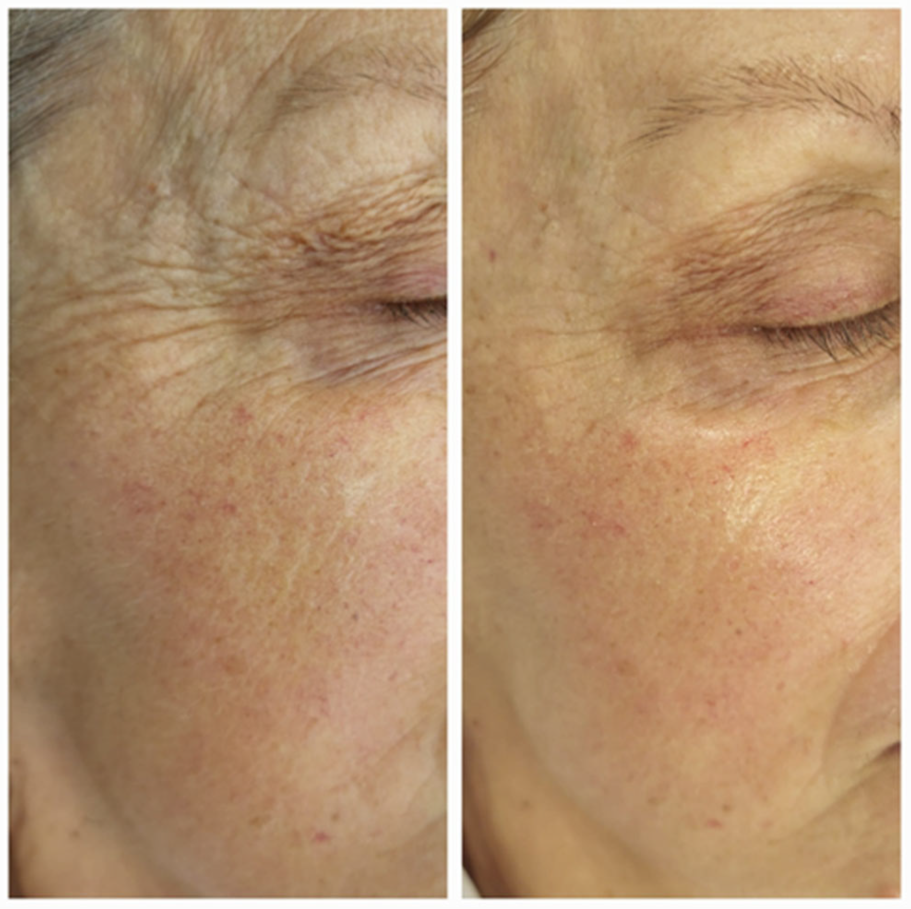 Cosmetics 13 00083 g010 Cosmetics 13 00083 g010