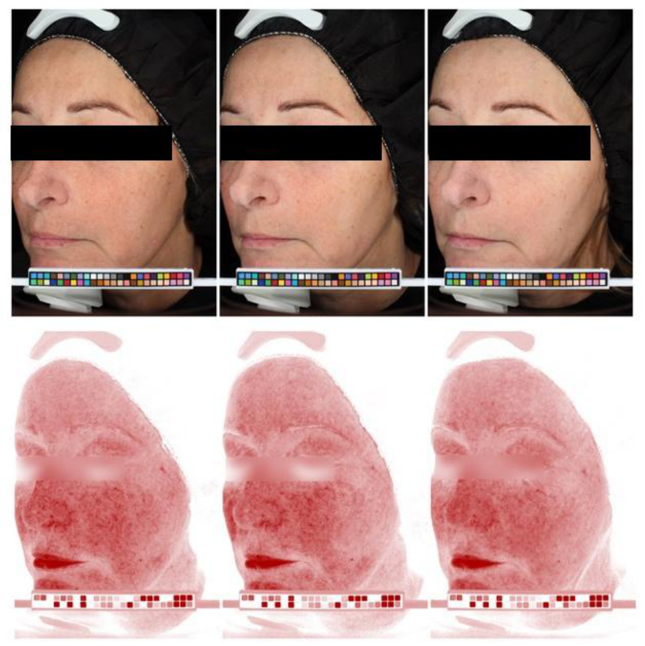 Cosmetics 13 00177 g004 Cosmetics 13 00177 g004