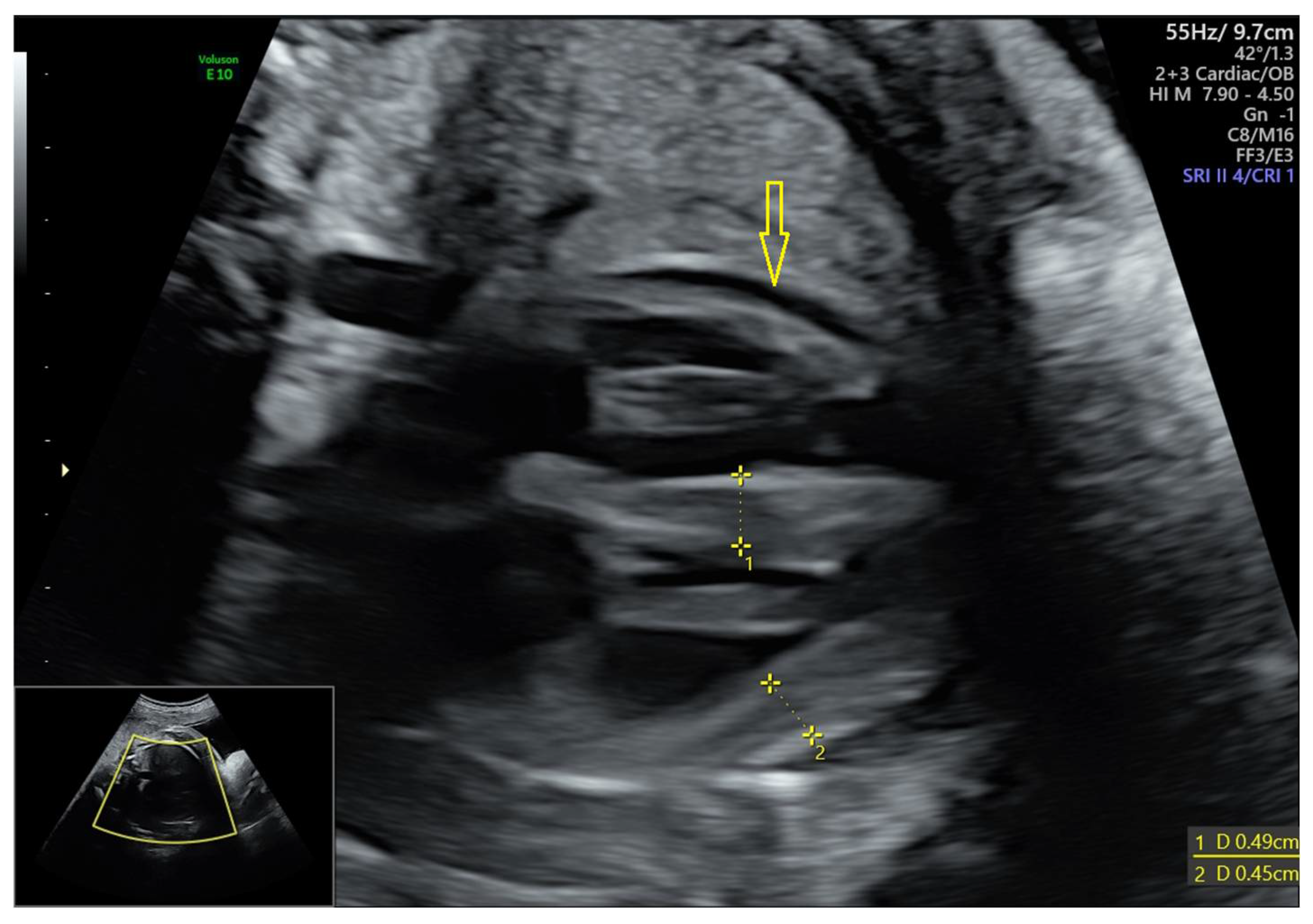 Covid 02 00061 g001 Covid 02 00061 g001