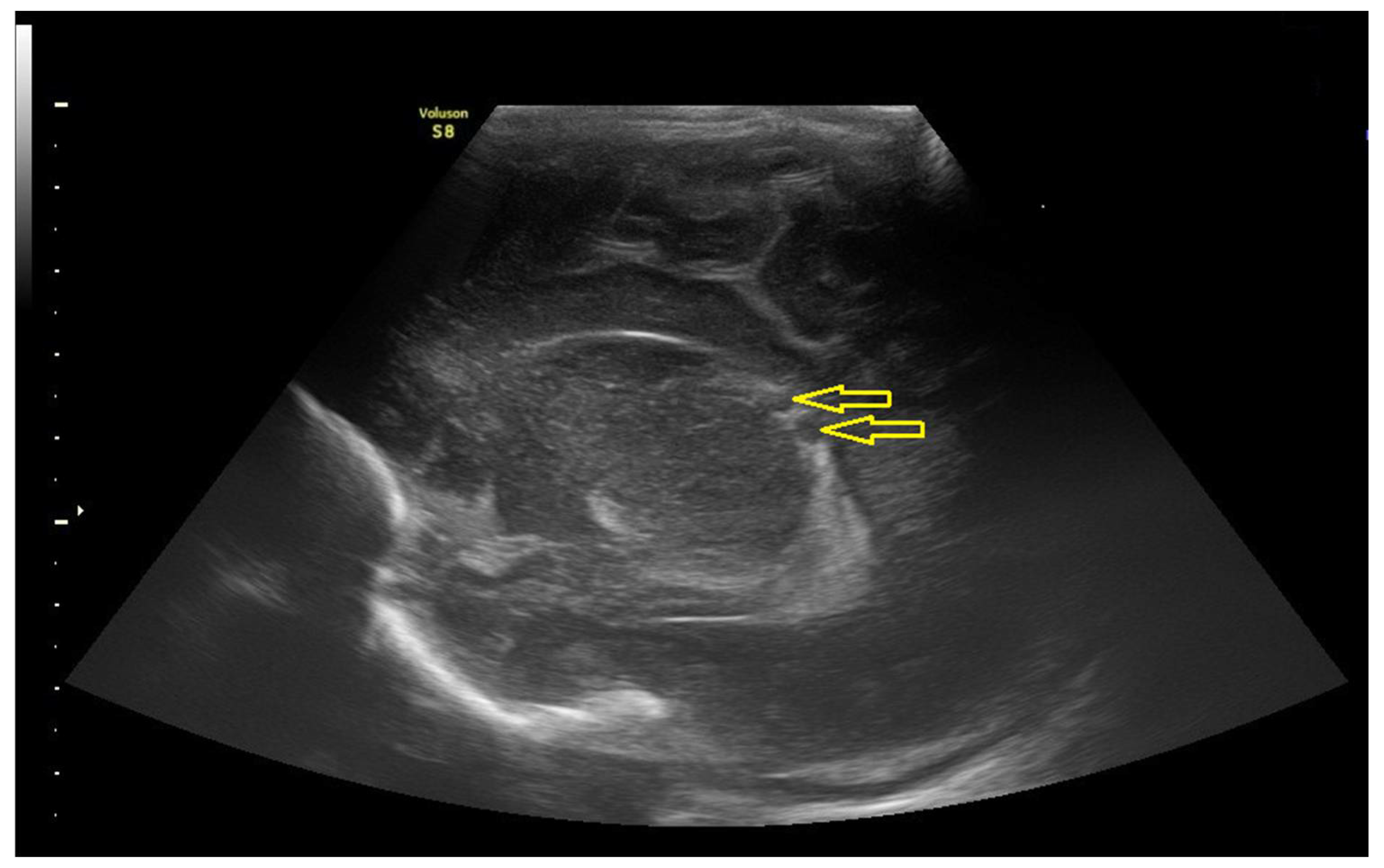 Covid 02 00061 g002 Covid 02 00061 g002