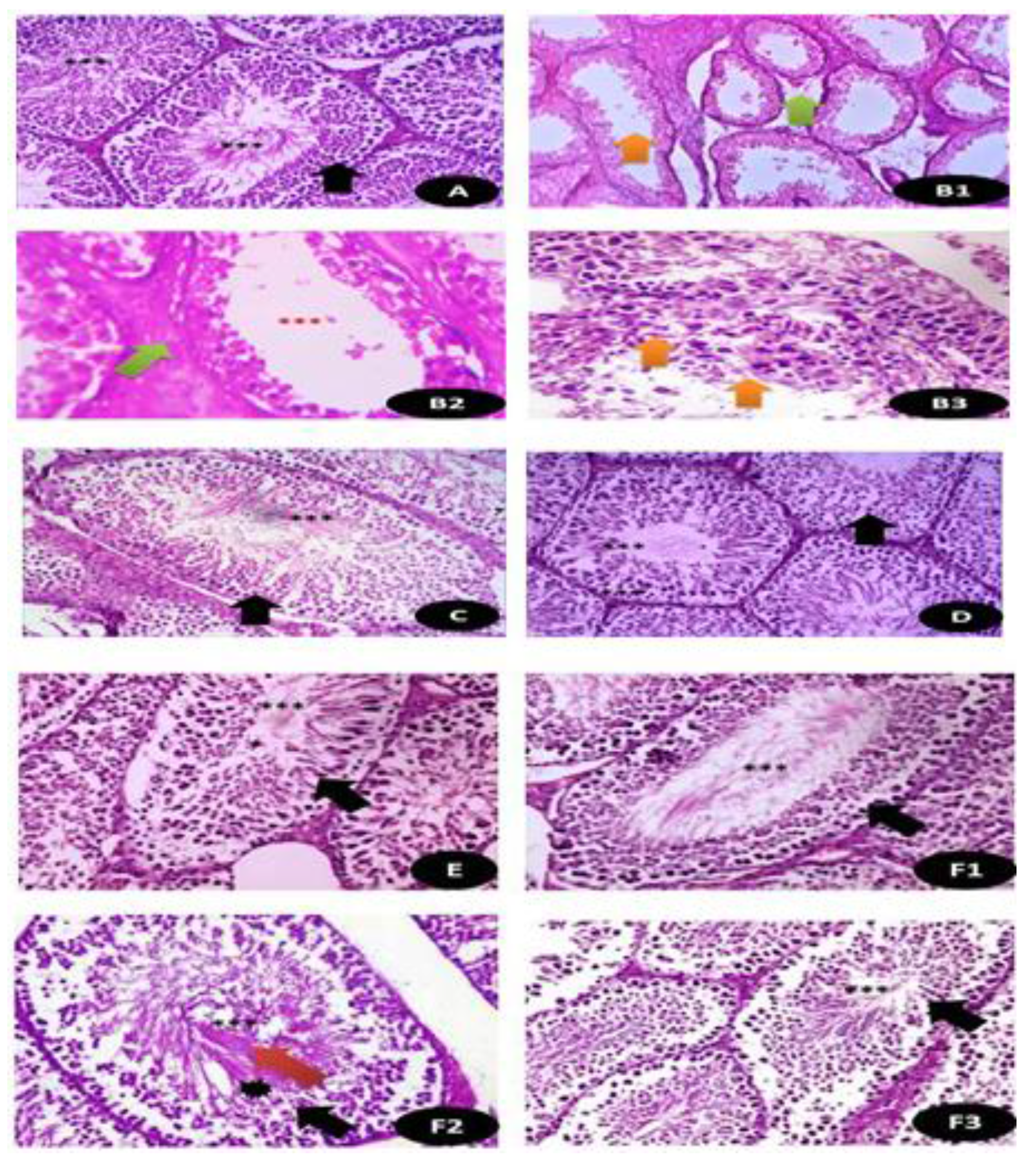Crystals 11 00367 g013 Crystals 11 00367 g013