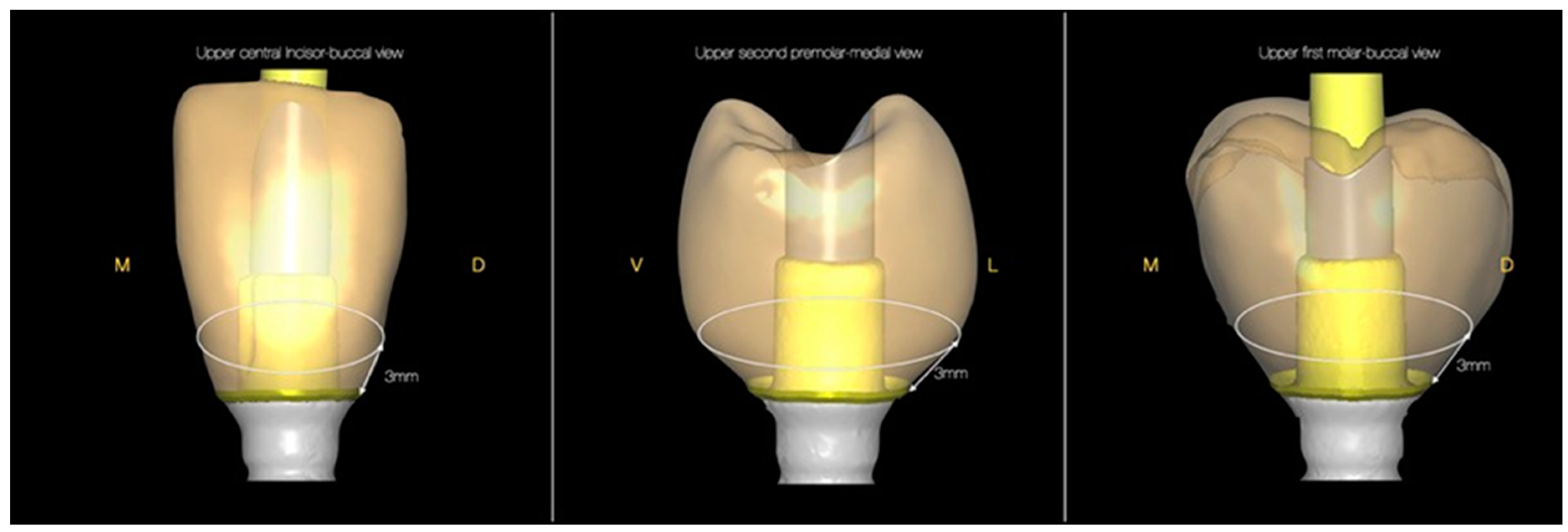 Crystals 12 00465 g005 550