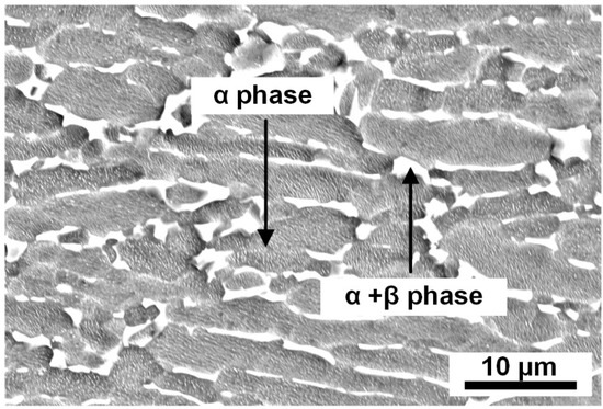 Microstructure and Mechanical Properties of Laser Narrow-Gap