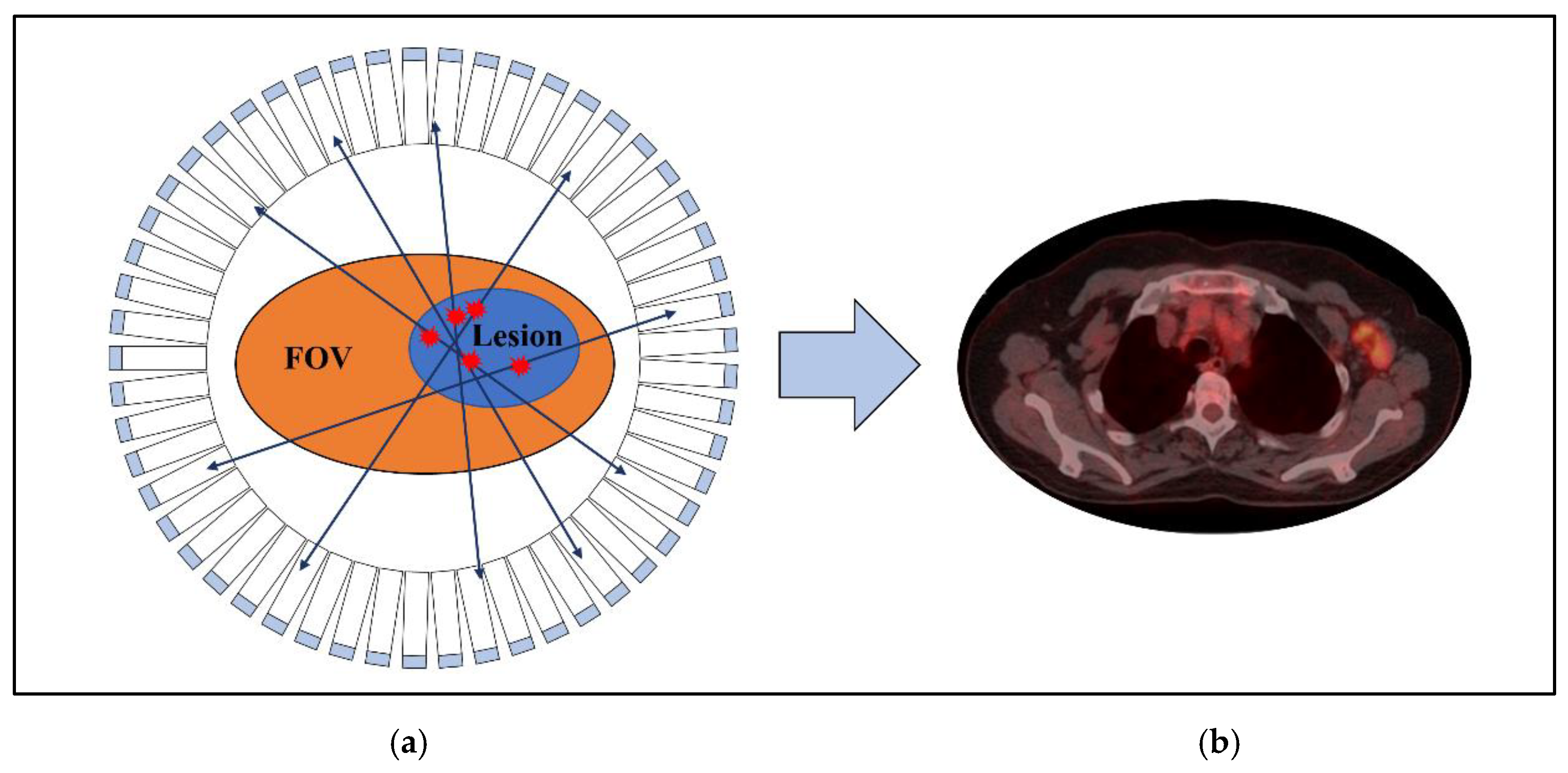 Pet Scanner Detector