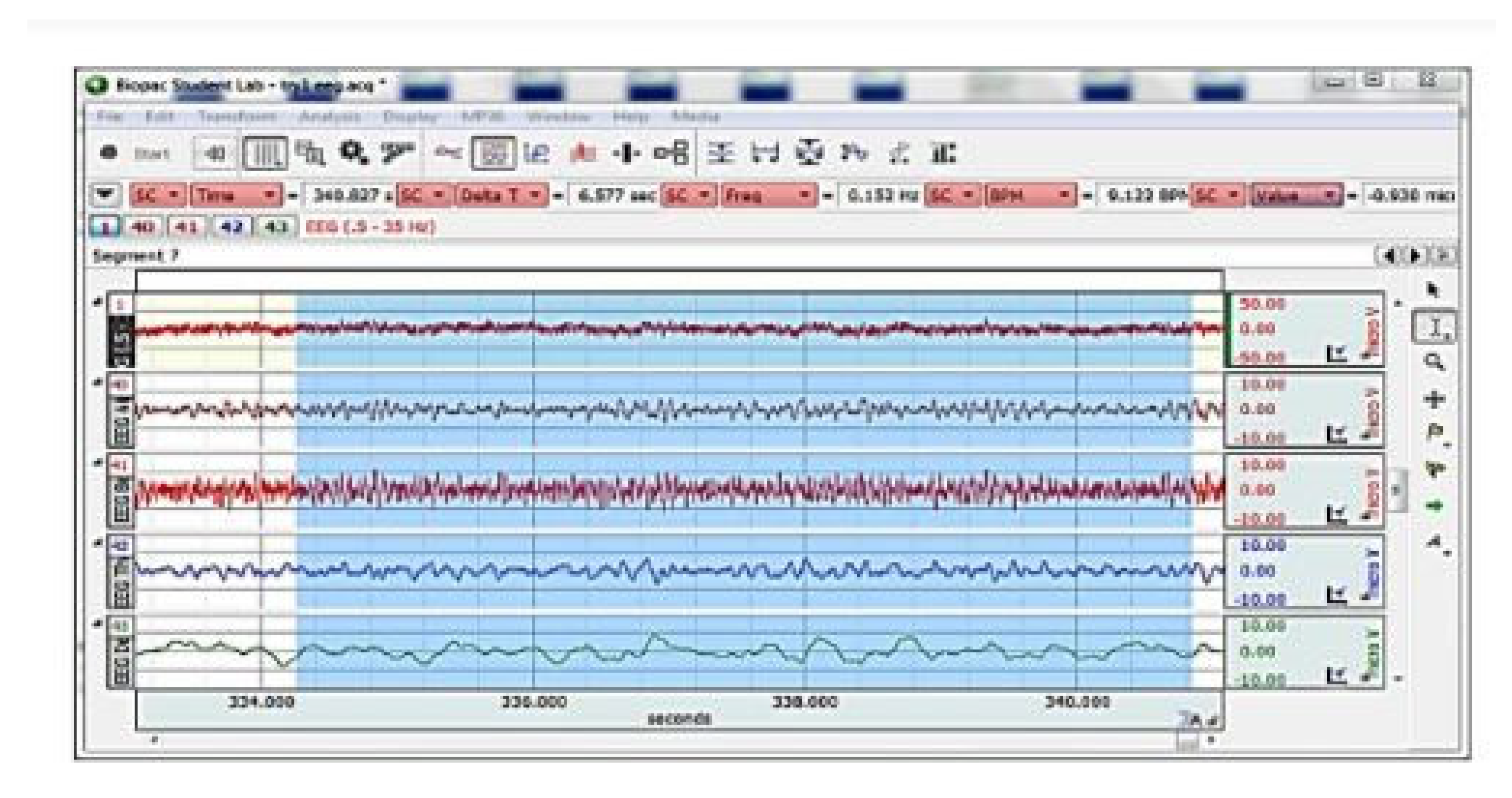 Crystals 12 01526 g007 Crystals 12 01526 g007