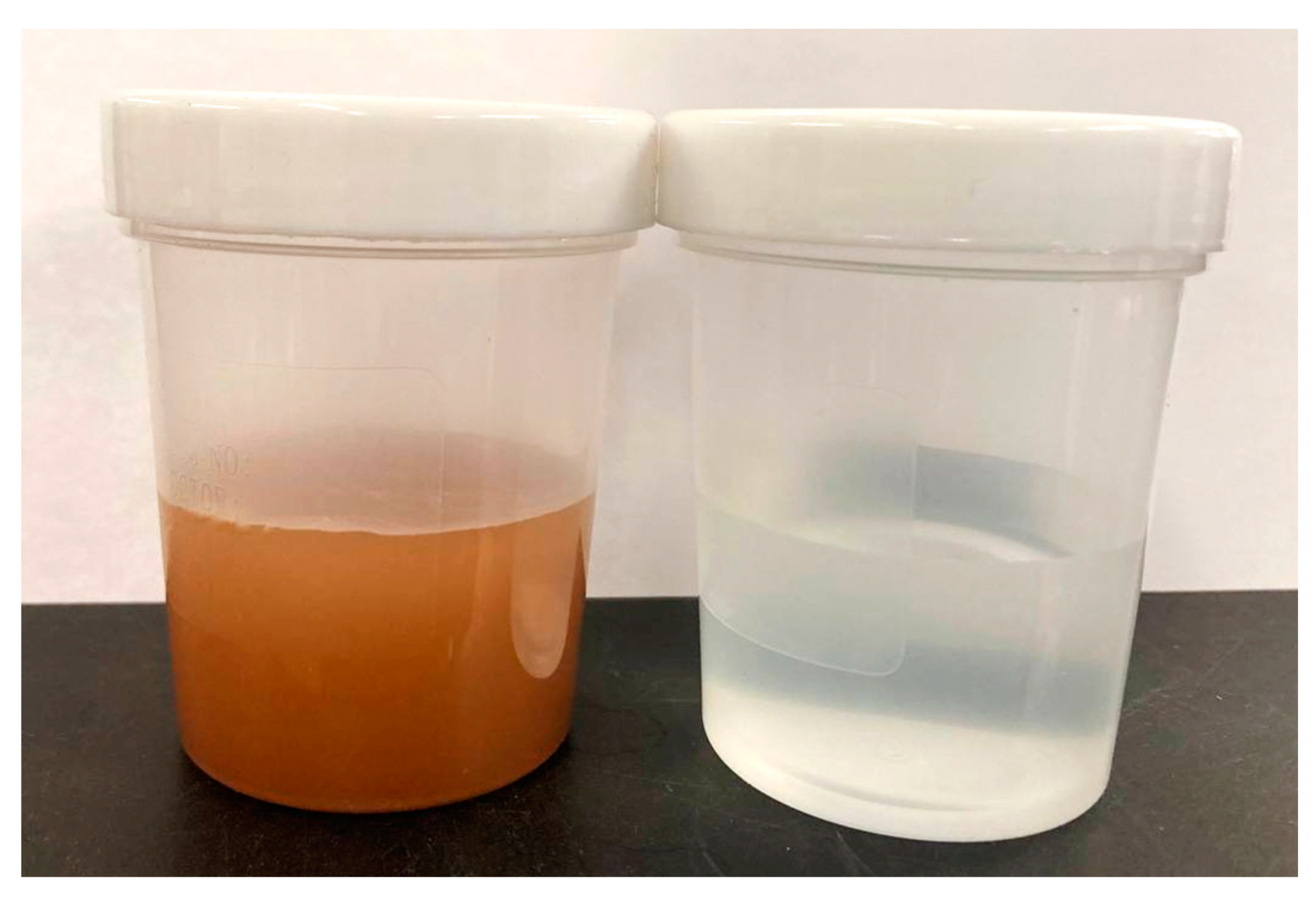 Crystals 13 01369 g018