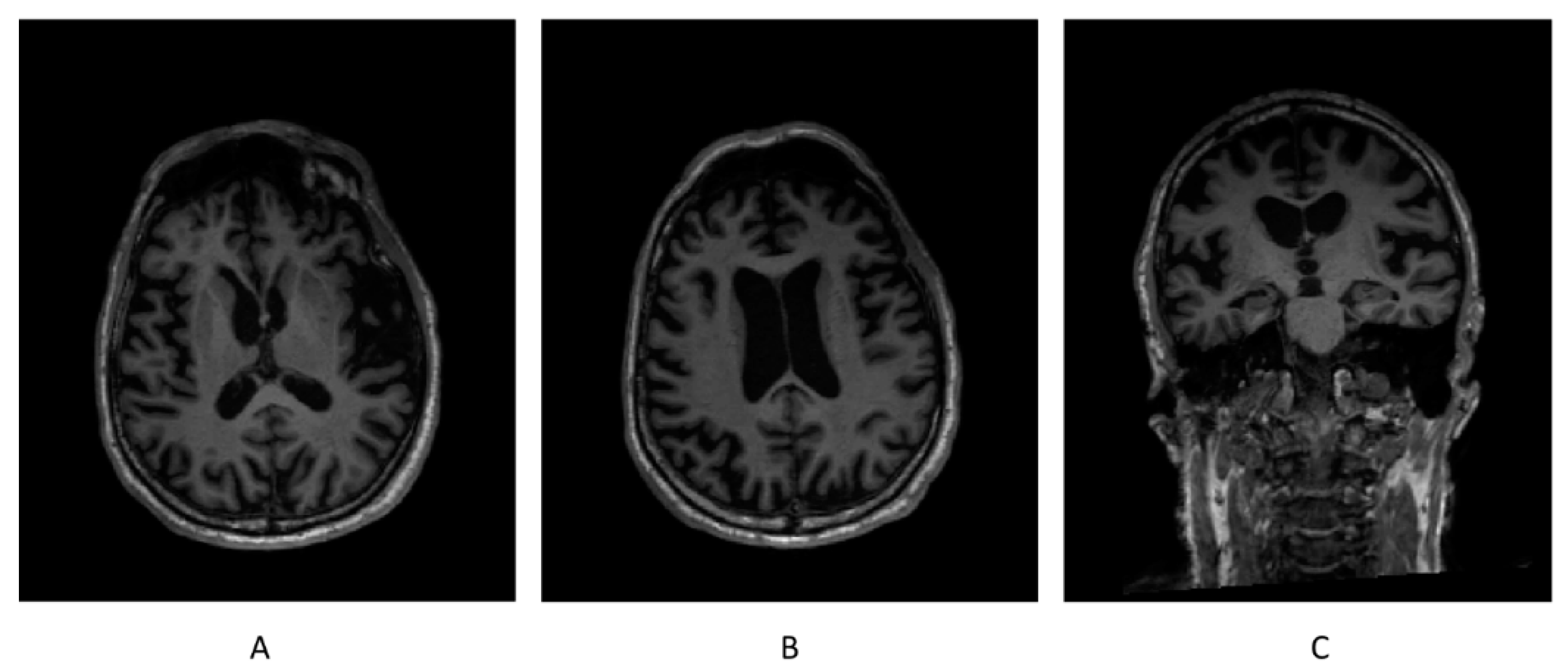 Ctn 06 00017 g004 550