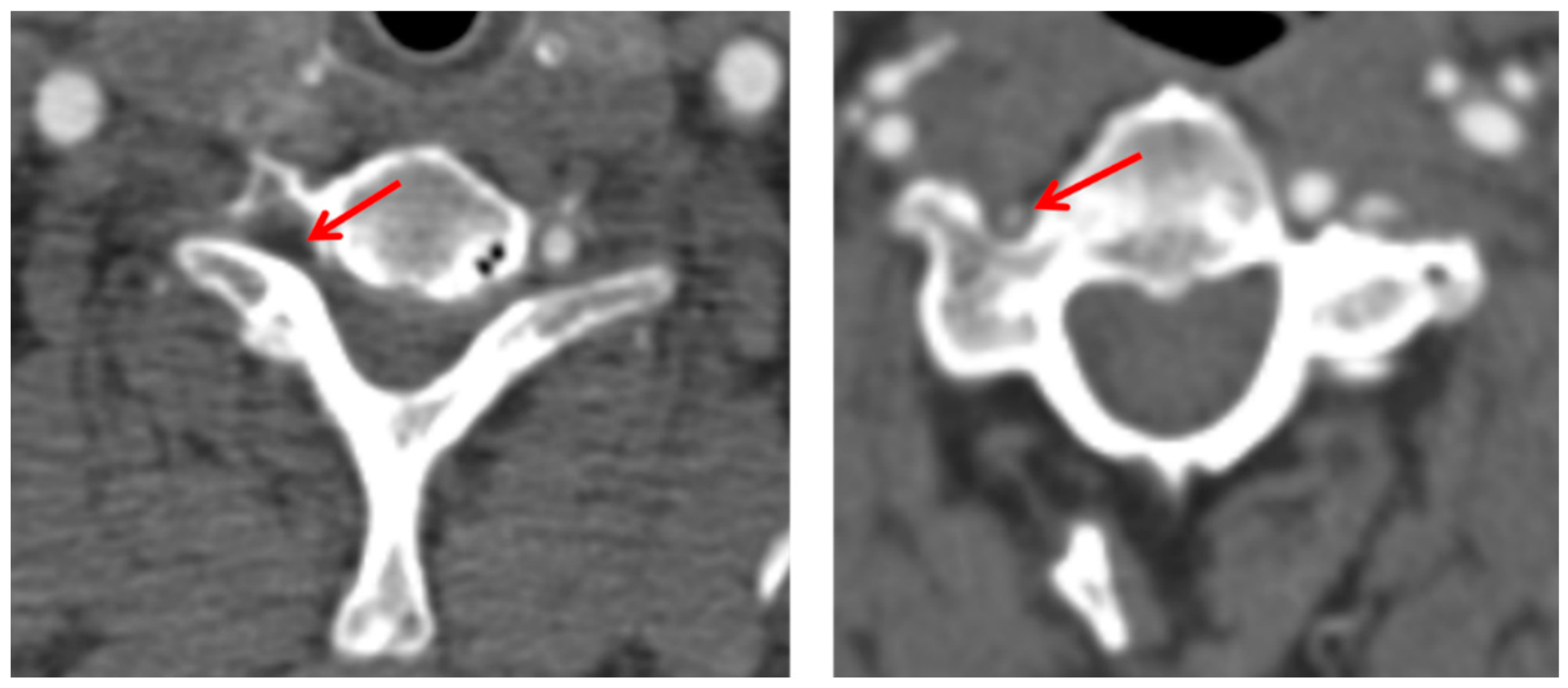 Ctn 07 00026 g002 Ctn 07 00026 g002