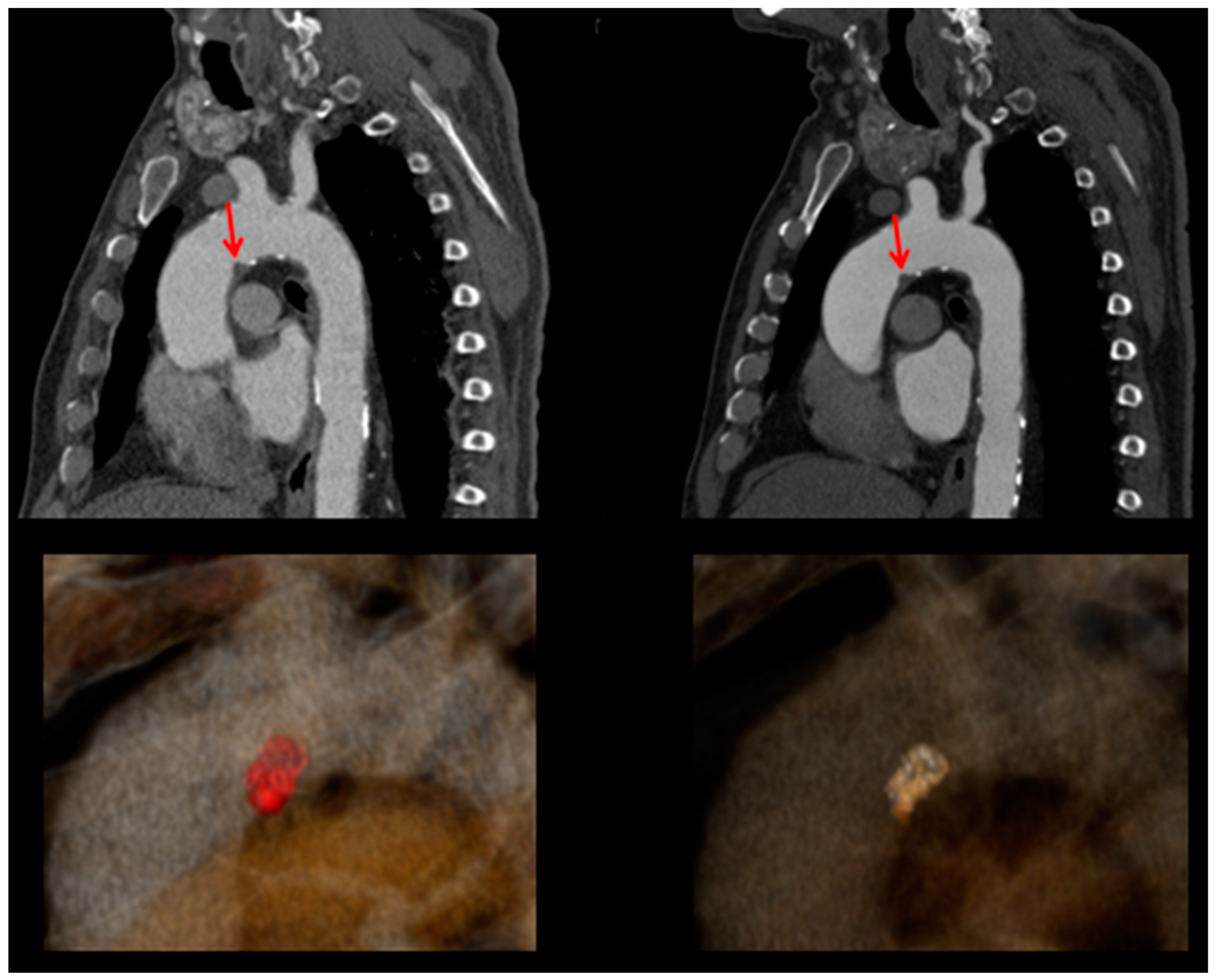 Ctn 07 00026 g005 Ctn 07 00026 g005