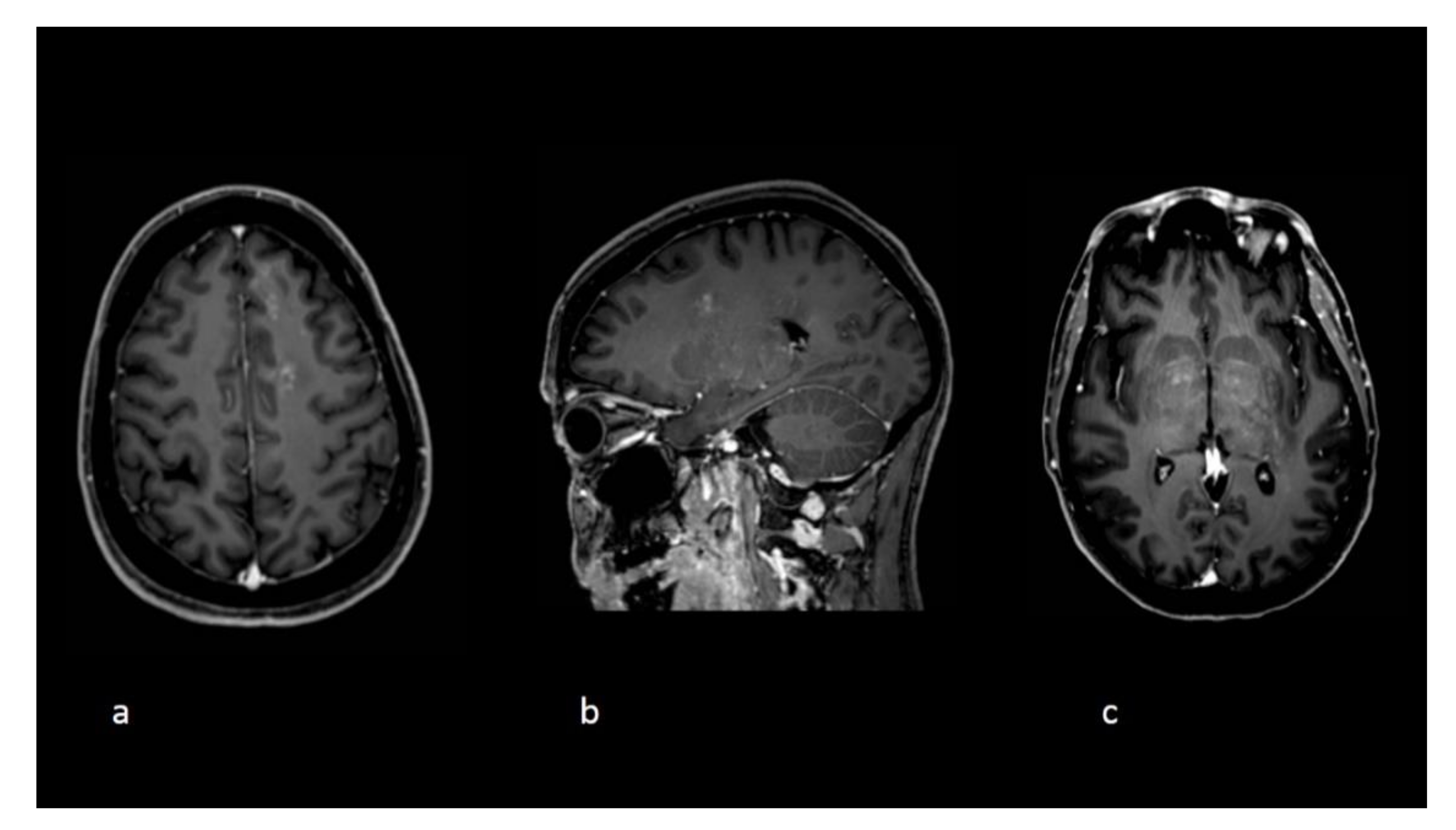 Curroncol 28 00022 g002 Curroncol 28 00022 g002