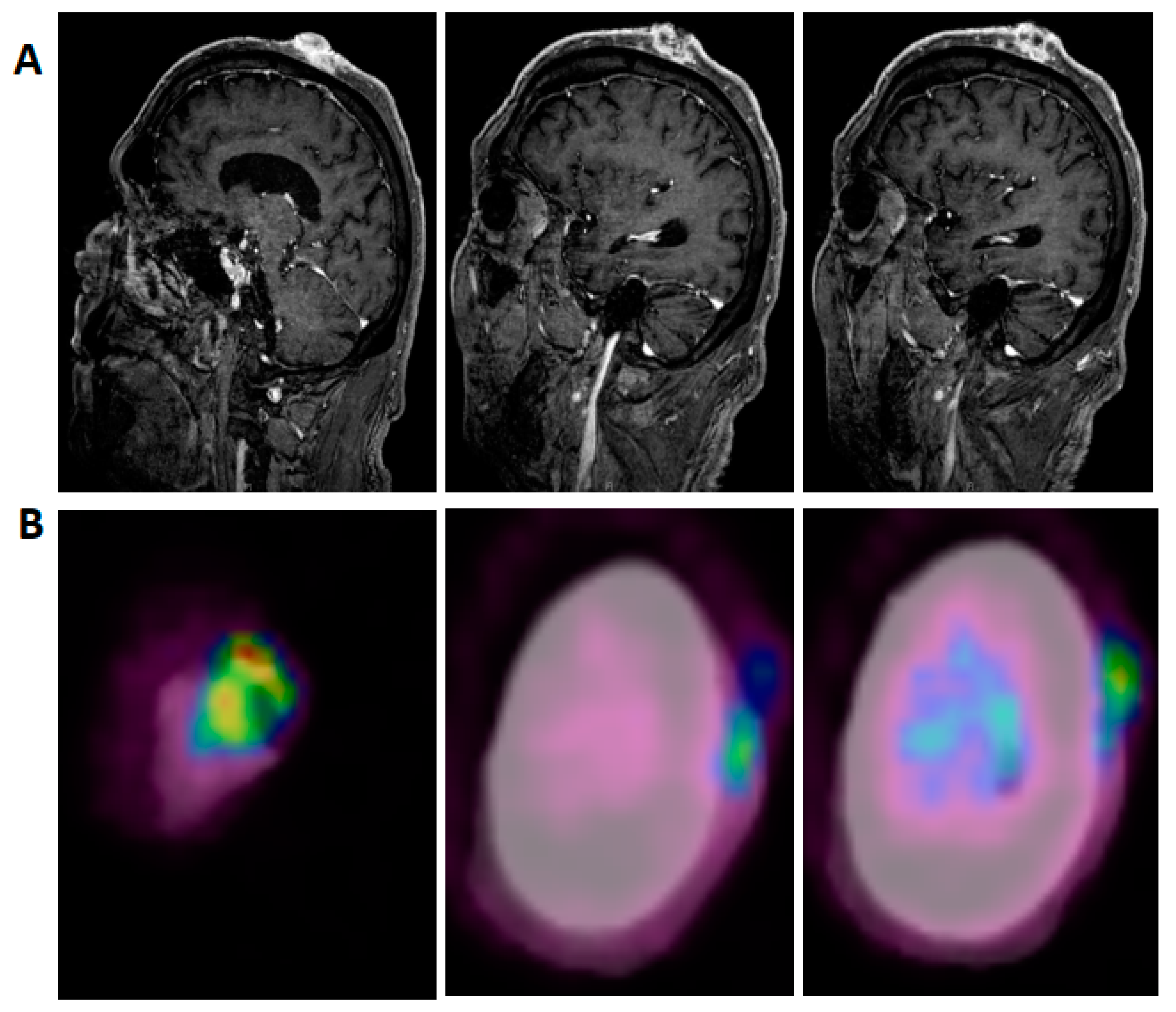 Curroncol 28 00057 g001 Curroncol 28 00057 g001