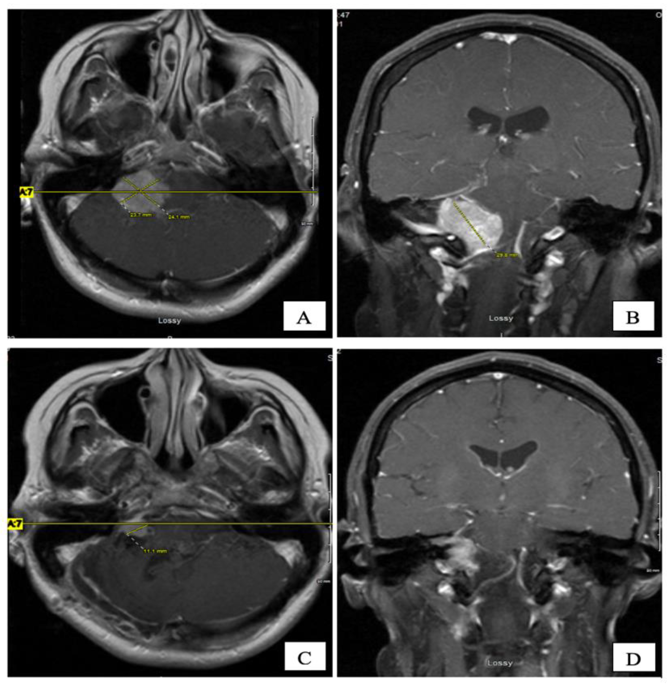 Curroncol 28 00073 g002