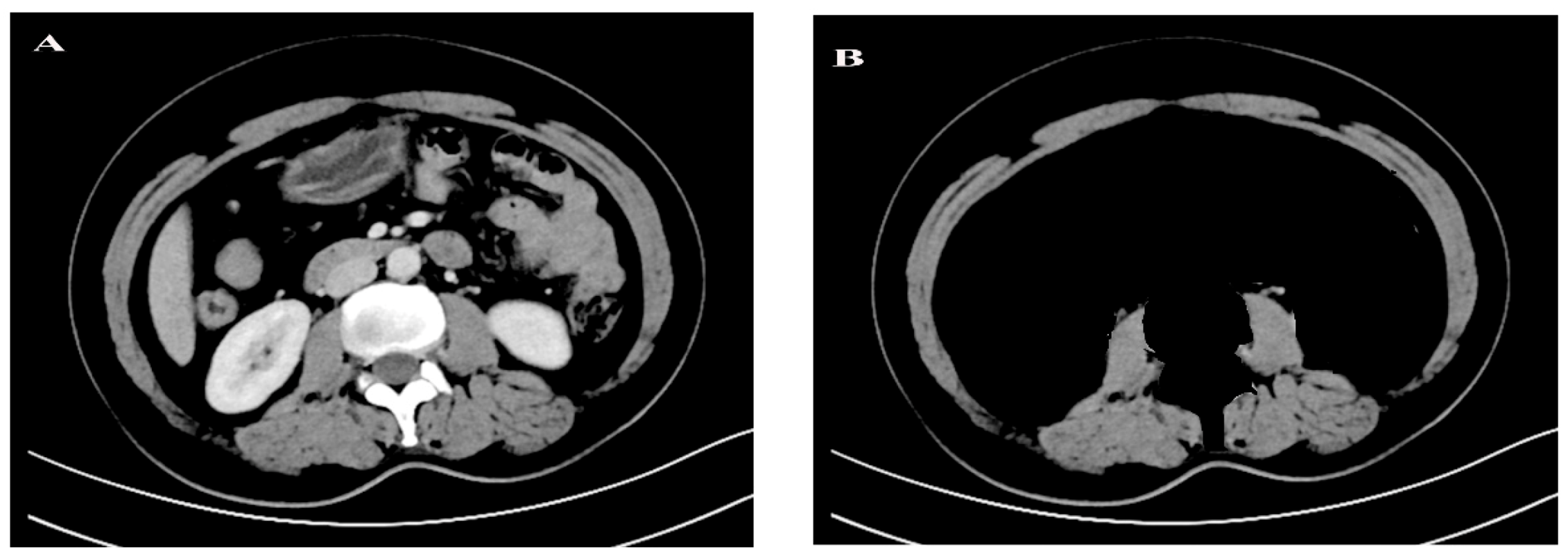 Curroncol 28 00126 g001 Curroncol 28 00126 g001