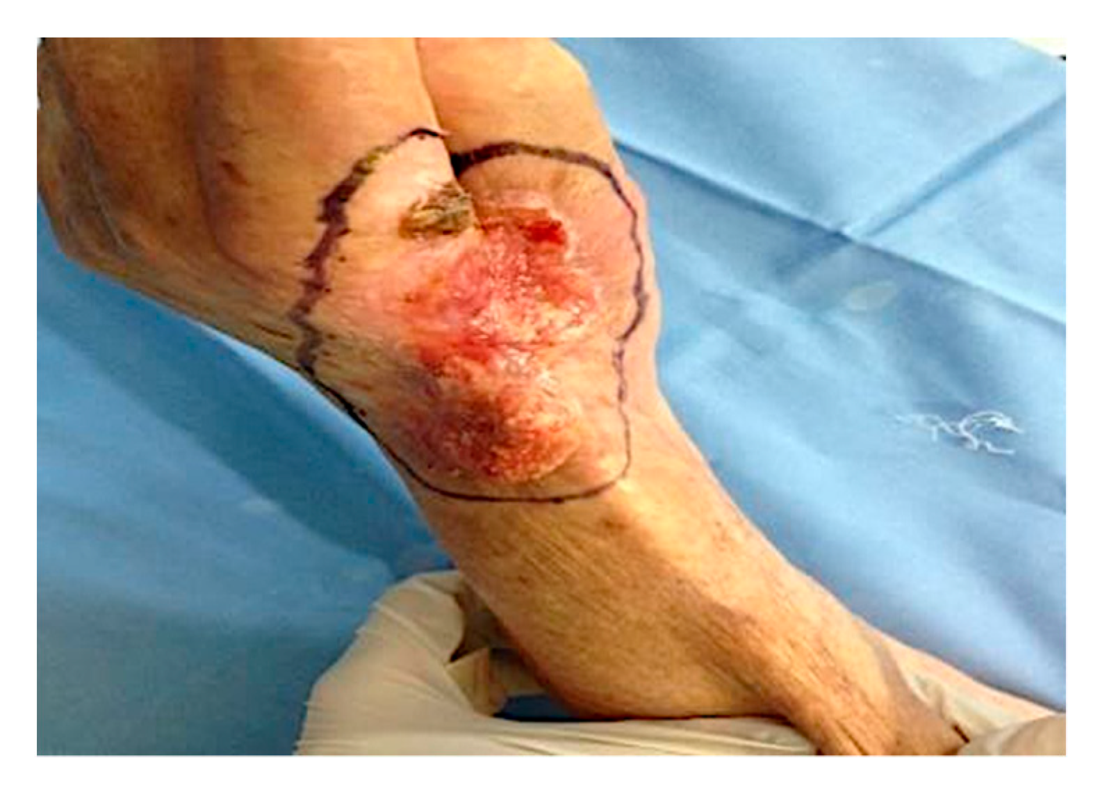 Curroncol 28 00160 g001