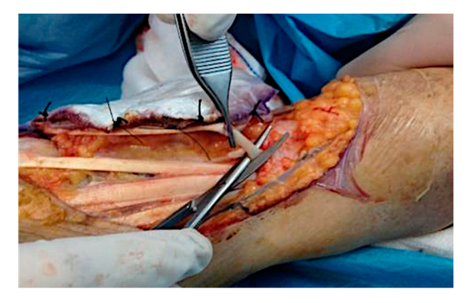 Curroncol 28 00160 g003