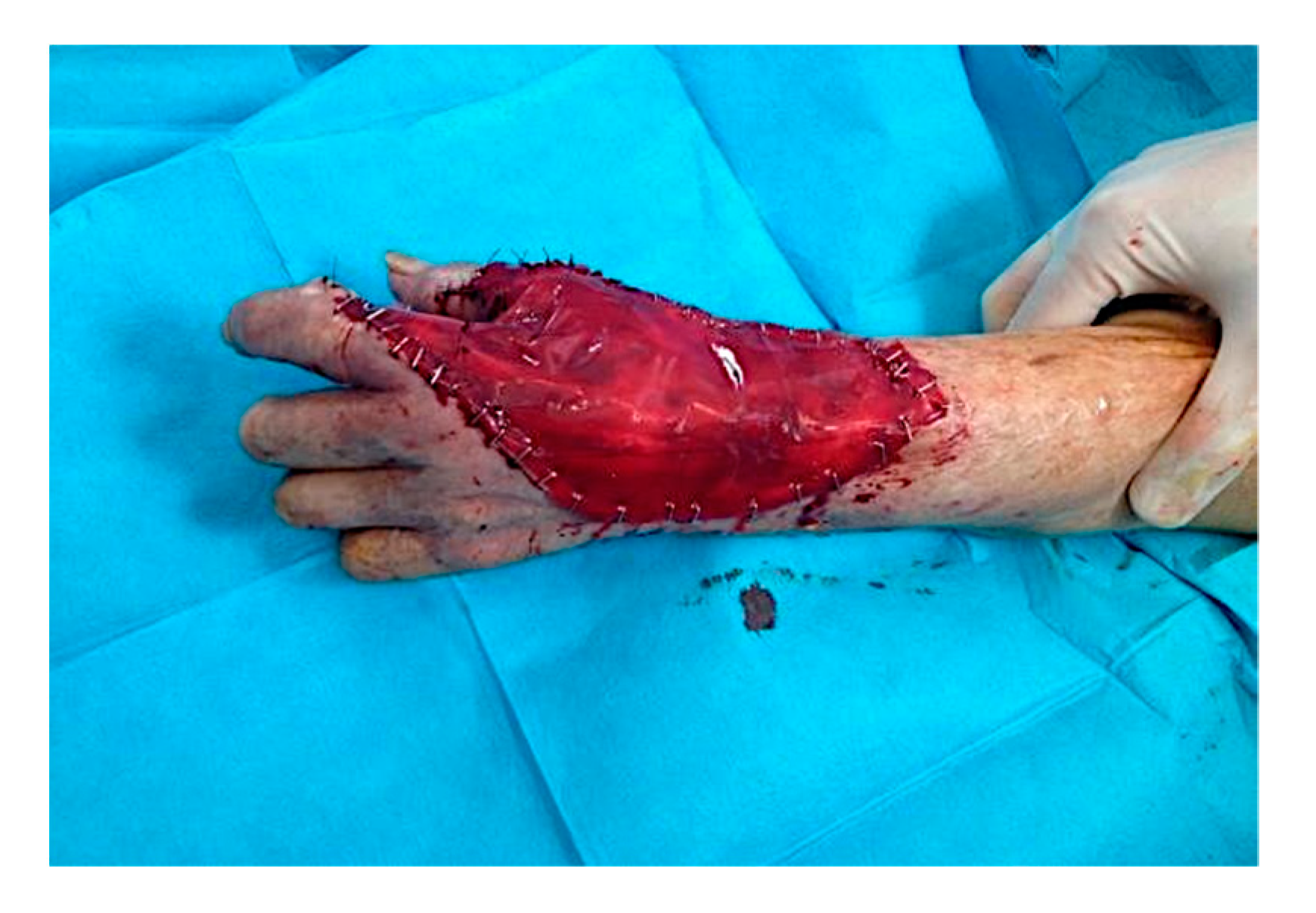 Curroncol 28 00160 g004