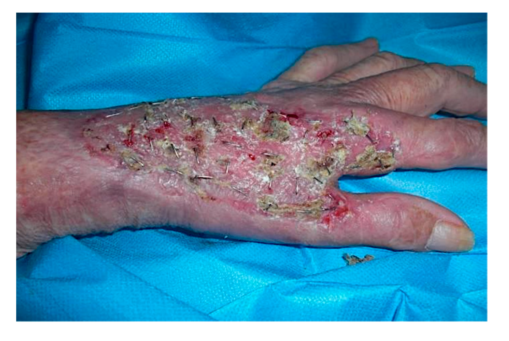 Curroncol 28 00160 g006