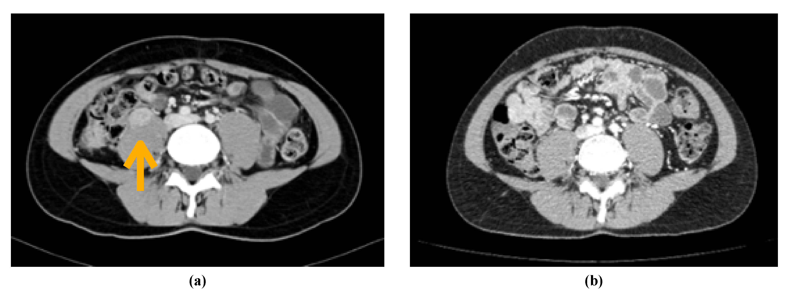 Curroncol 28 00216 g004