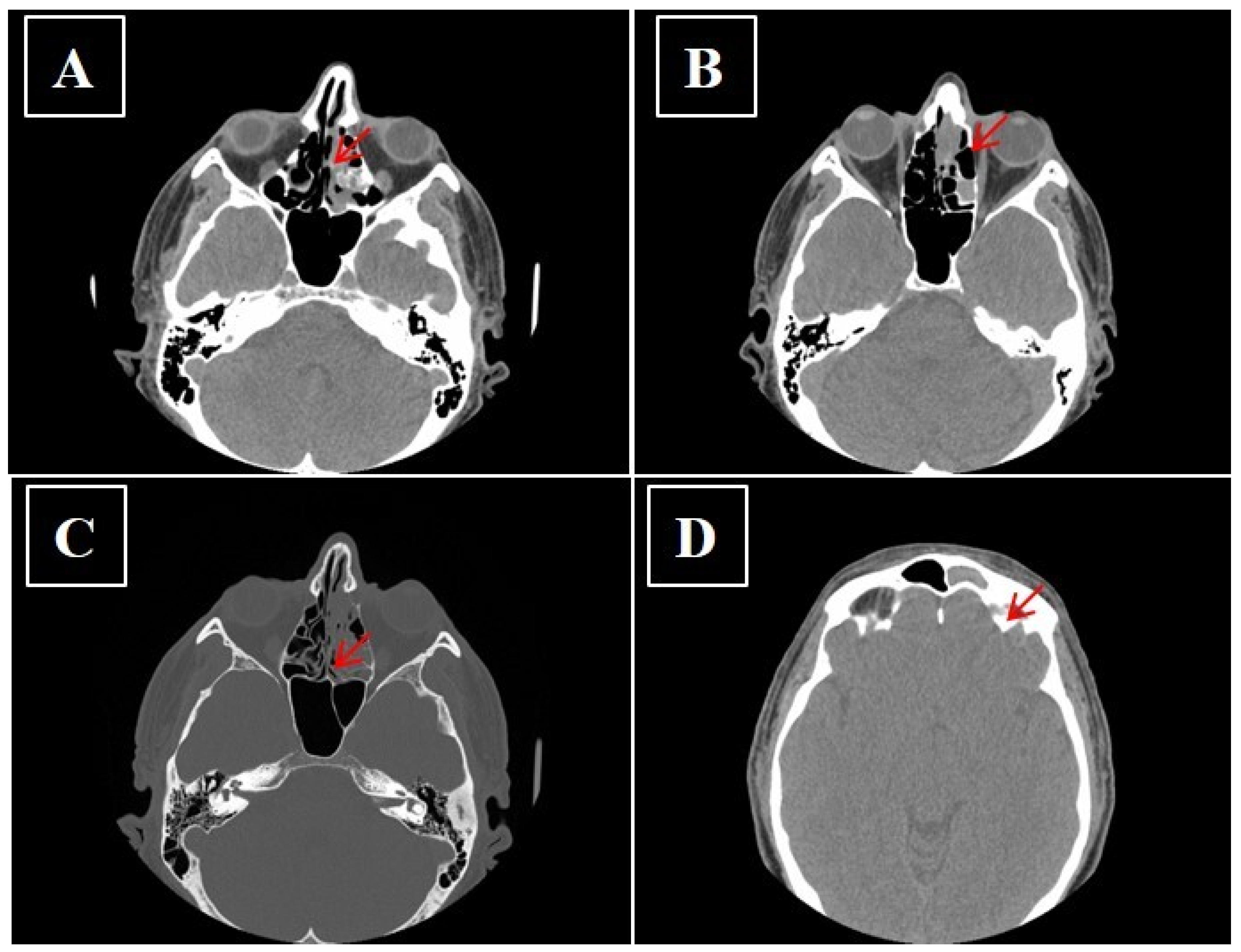 Curroncol 28 00222 g005